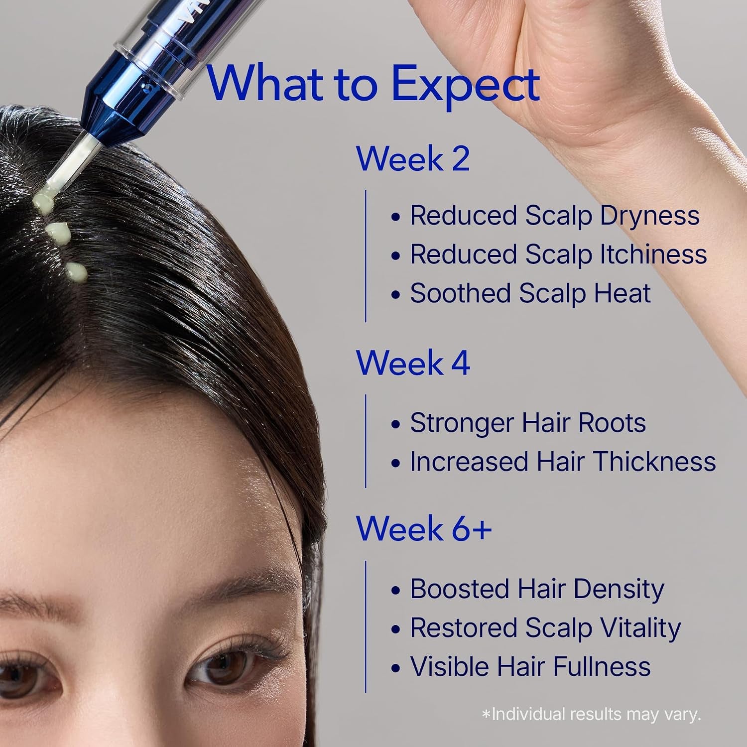 Vivelab Spioxyl 400 Microneedling Hair Growth Serum - Volumizing Scalp Treatment for Root Lifting, Scalp Care with Biotin, Caffeine & Peptides, Clinically Tested Spicule for Thicker & Stronger Hair