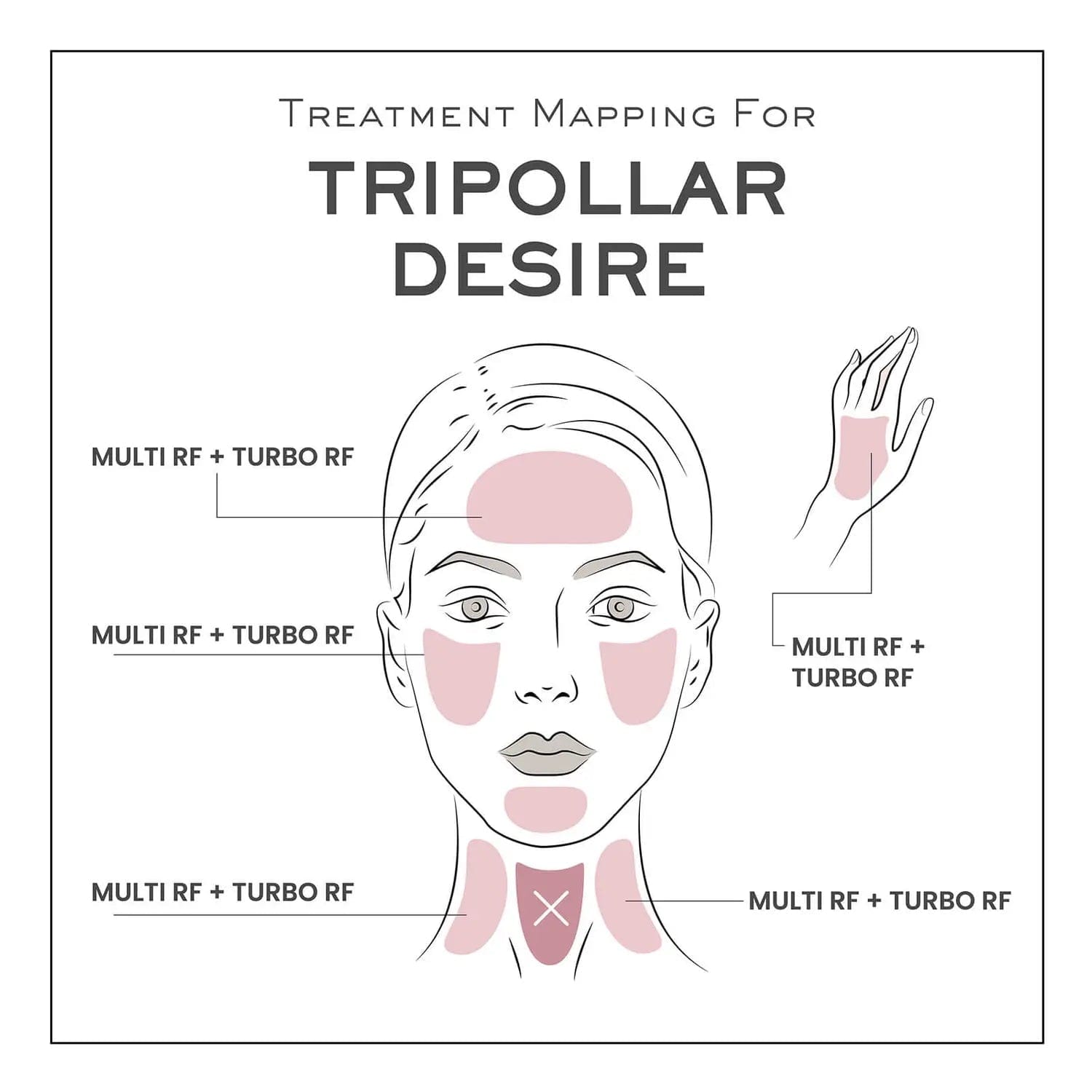 TriPollar DESIRE Radio Frequency Device – At-Home RF Skin Tightening & Rejuvenation Tool