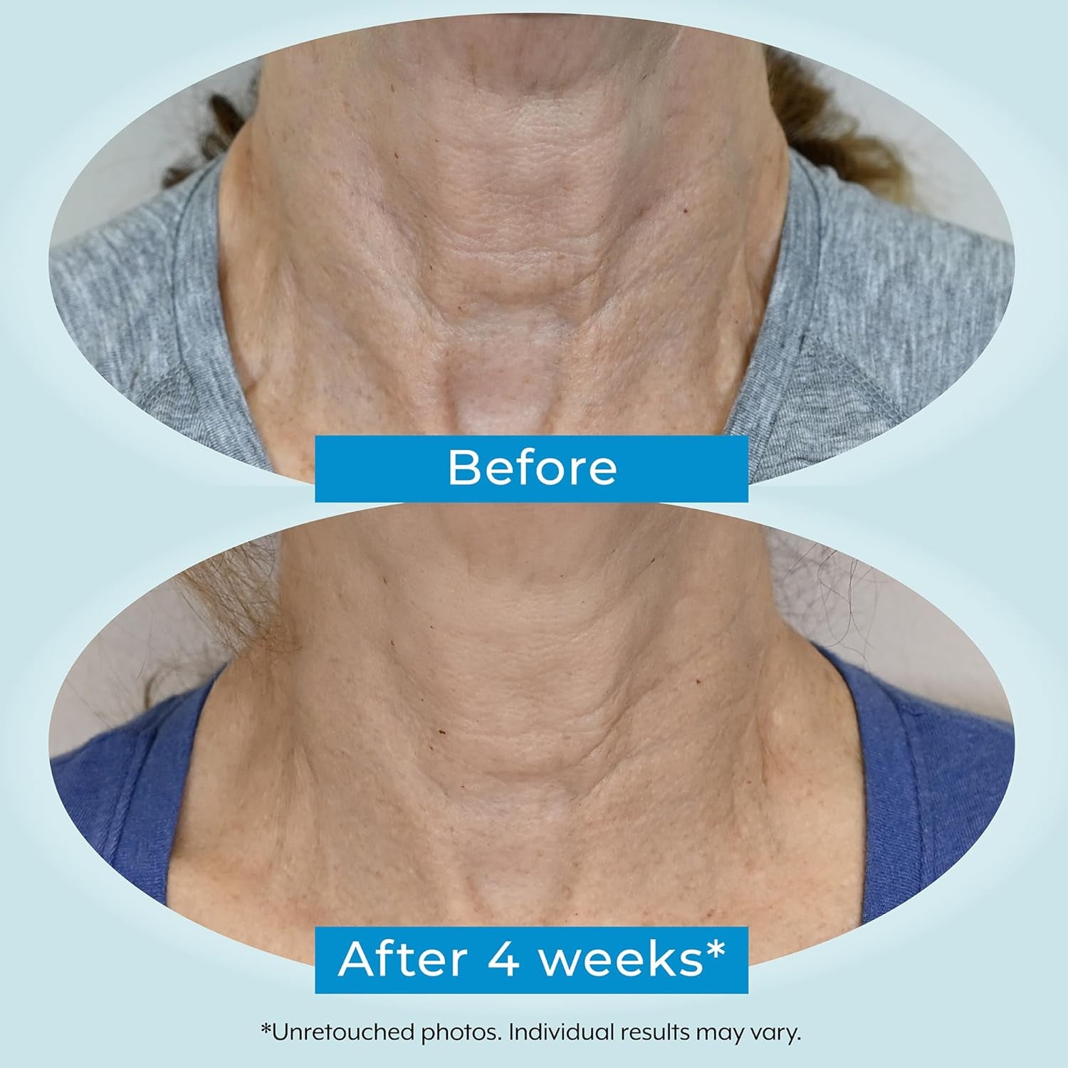 Plexaderm Dual Action Repair 1% Retinol Neck Cream. anti Aging Cream with Retinol, Bakuchiol, and Hyaluronic Acid to Fight Wrinkles, Neck Lines and Crepey Skin, 1 Fl. Oz.