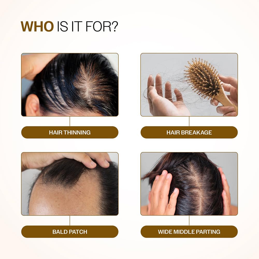 Bare Anatomy Advanced Hair Density Serum | 3% Redensyl, 4% Anagain, 3% Baicapil, 1% Capilia Longa, Rosemary, Biotin & Rice Extract | Reduces Hair Fall, Supports Hair Growth for Men & Women | 30 Ml