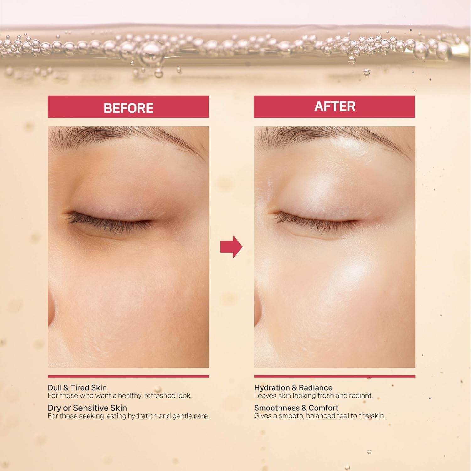 Cleosis Salmon DNA PDRN 250,000ppm Serum – EGF Peptide & 25% Growth Factor Anti-Ageing Booster | Microneedling Compatible | 30ml | Korean Skincare