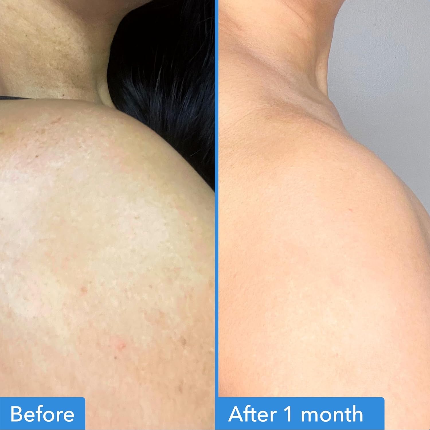 Good Molecules Discoloration Correcting Body Treatment – 200ml