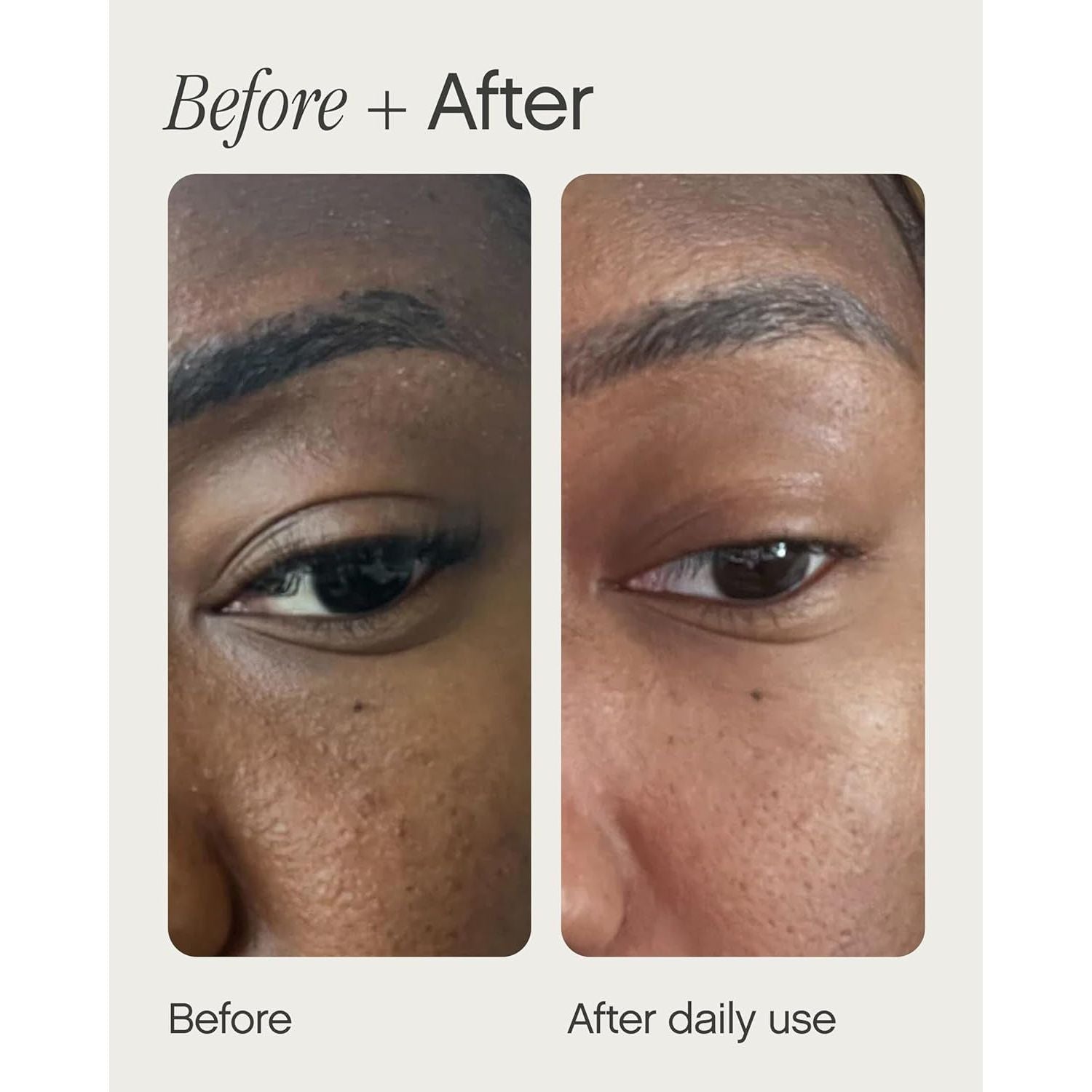 Topicals Sealed Active Scar Primer – 28ml | Instantly Smooths & Improves Scar Appearance