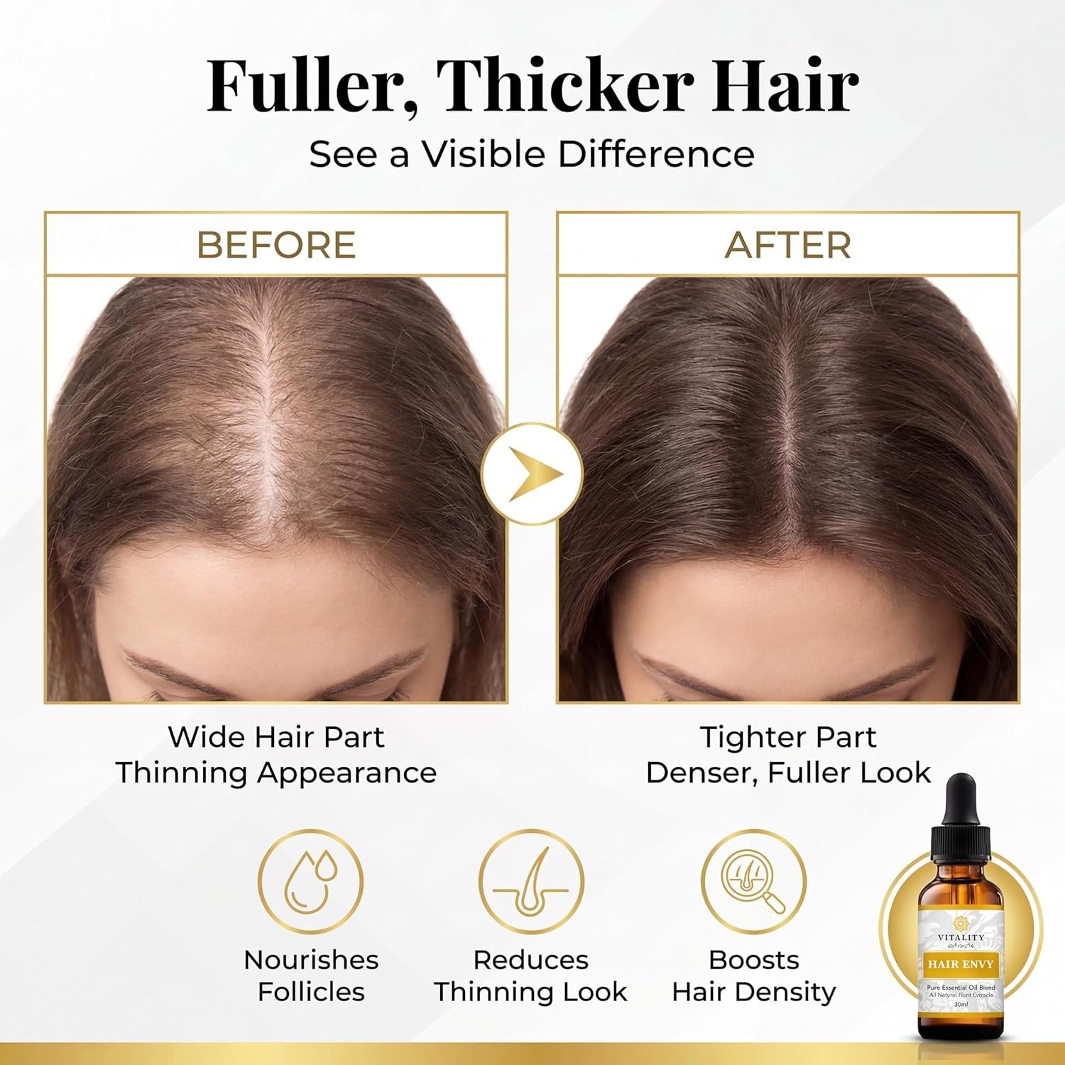 Vitality Extracts Hair Envy - Natural Hair Growth Serum - 100% Pure Essential Oils, 15 Plant Extracts, No Synthetics, No Parabens - Strengthen Hair, Minimize Breakage, Stimulate Follicles