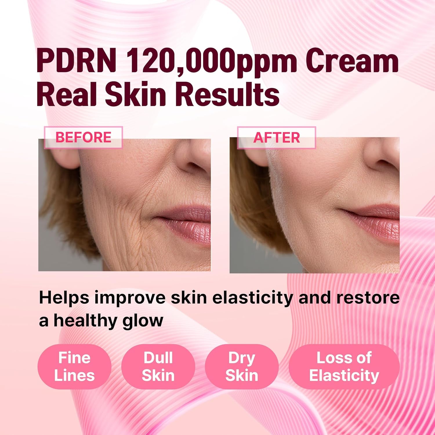 CELDYQUE PDRN 120,000ppm EGF Peptide Cream – Volufiline, Salmon DNA & Niacinamide Post-Microneedling Aftercare | Anti-Ageing | 50ml