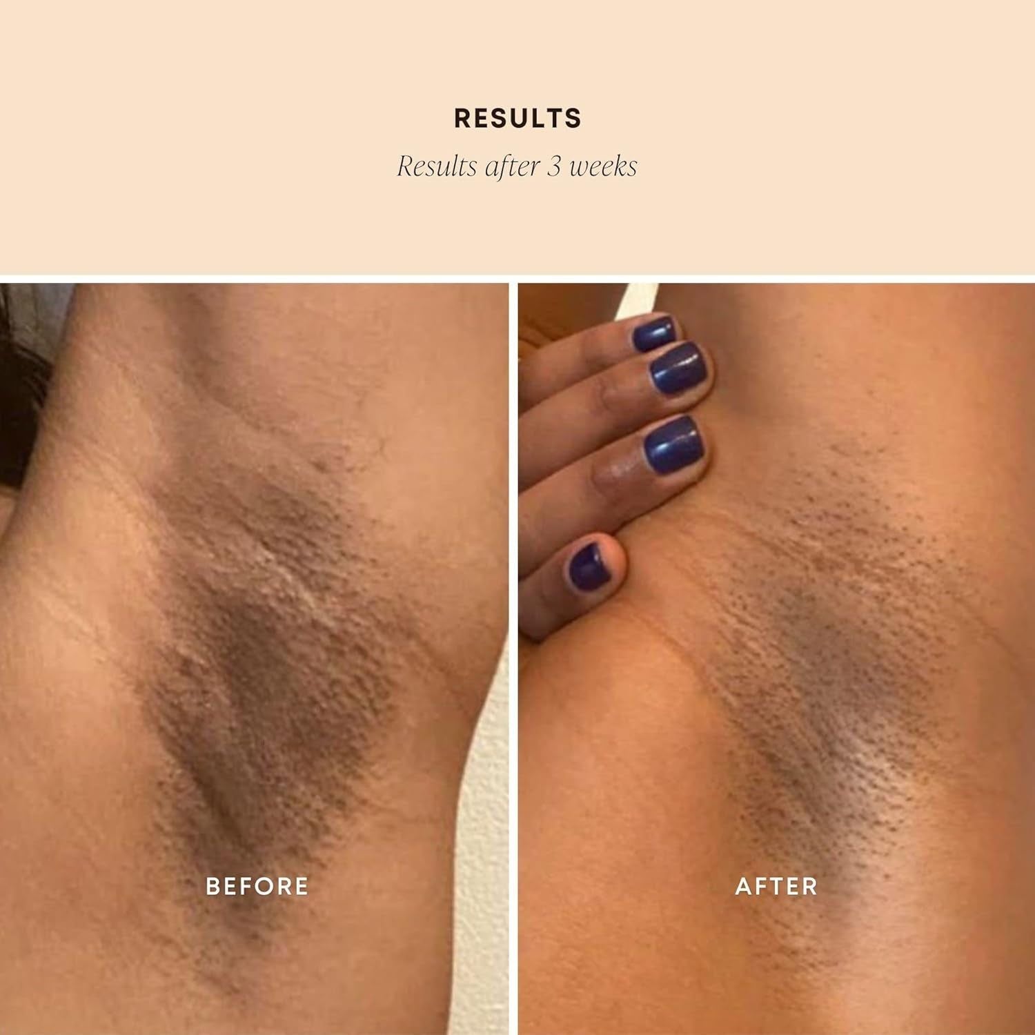 Bushbalm Dark Spot Exfoliating Scrub - Bermuda (236ml) | Brighten & Smooth Your Skin Naturally