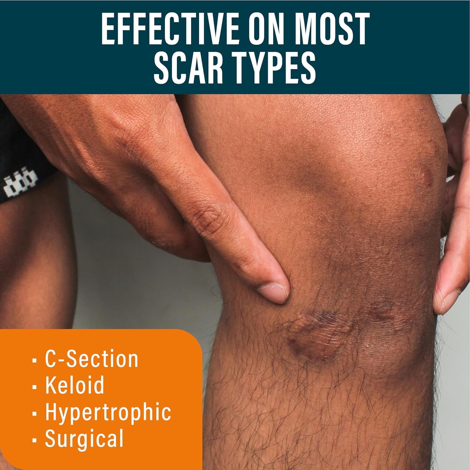 Nuvadermis Scar Gel - Targeted Recovery Scar Cream for Surgical Scars - 50ml