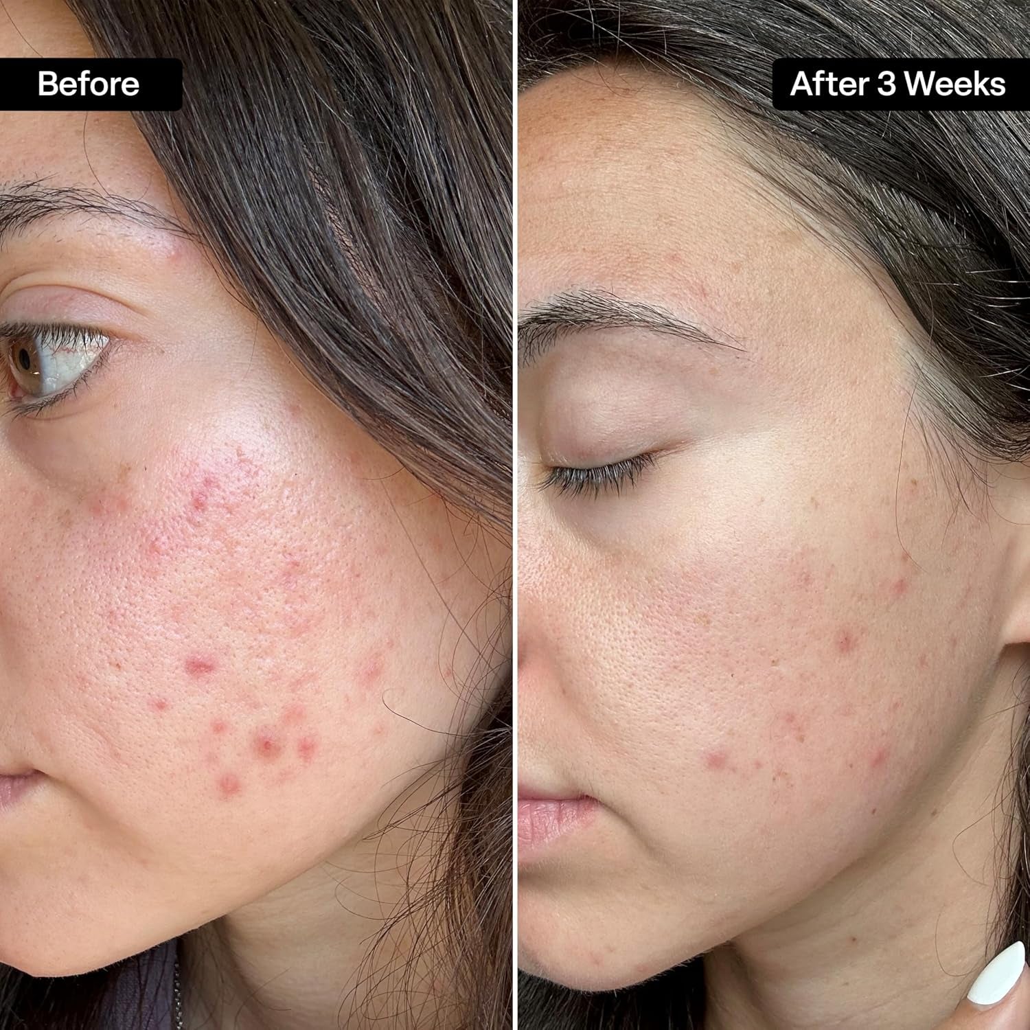QRxLabs Salicylic and Glycolic Acid Pads – product view 3