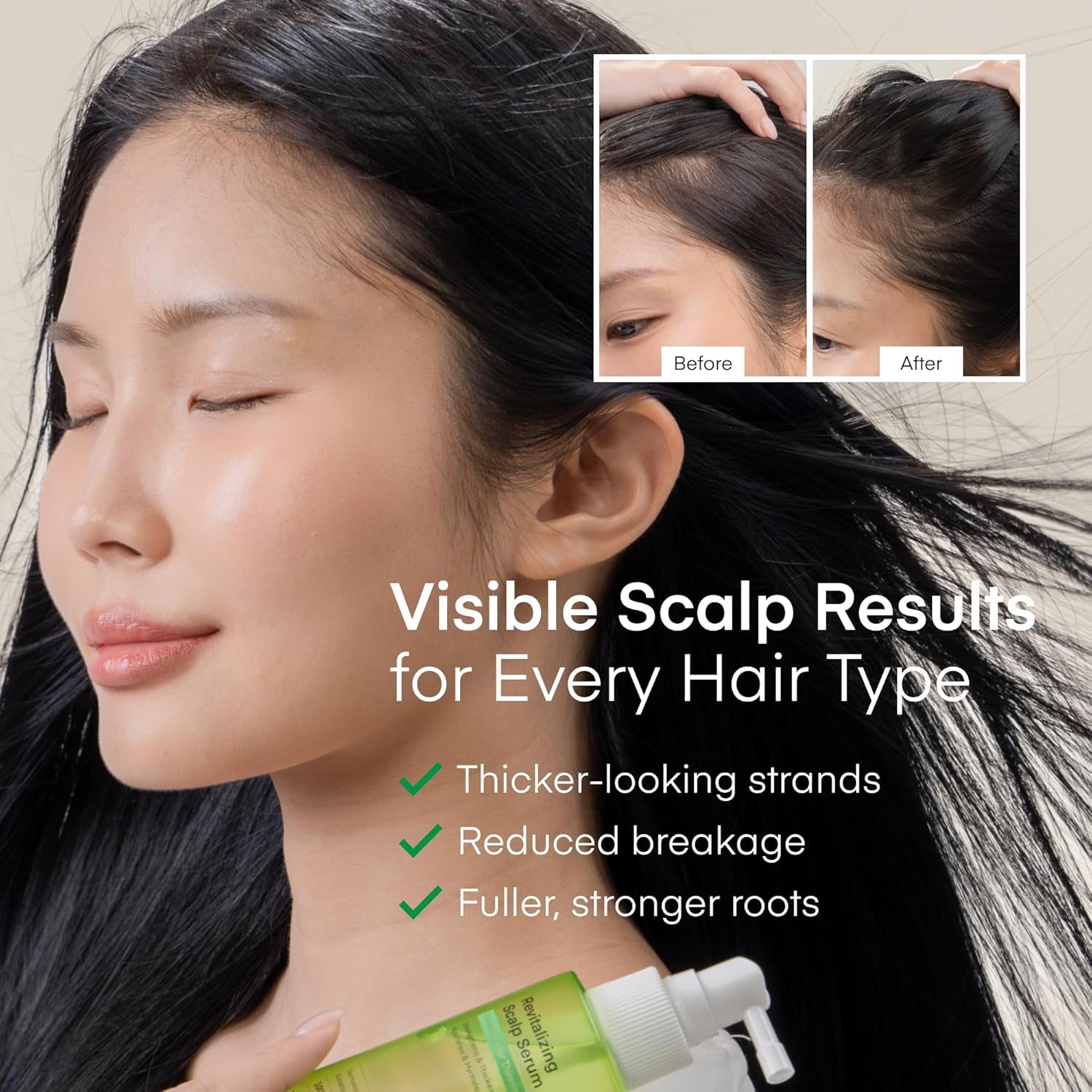 Terez & Honor Korean Hair Growth Scalp Serum – Lightweight Spray for Hair Loss, Thinning & Itchy Scalp | Vegan | 100ml