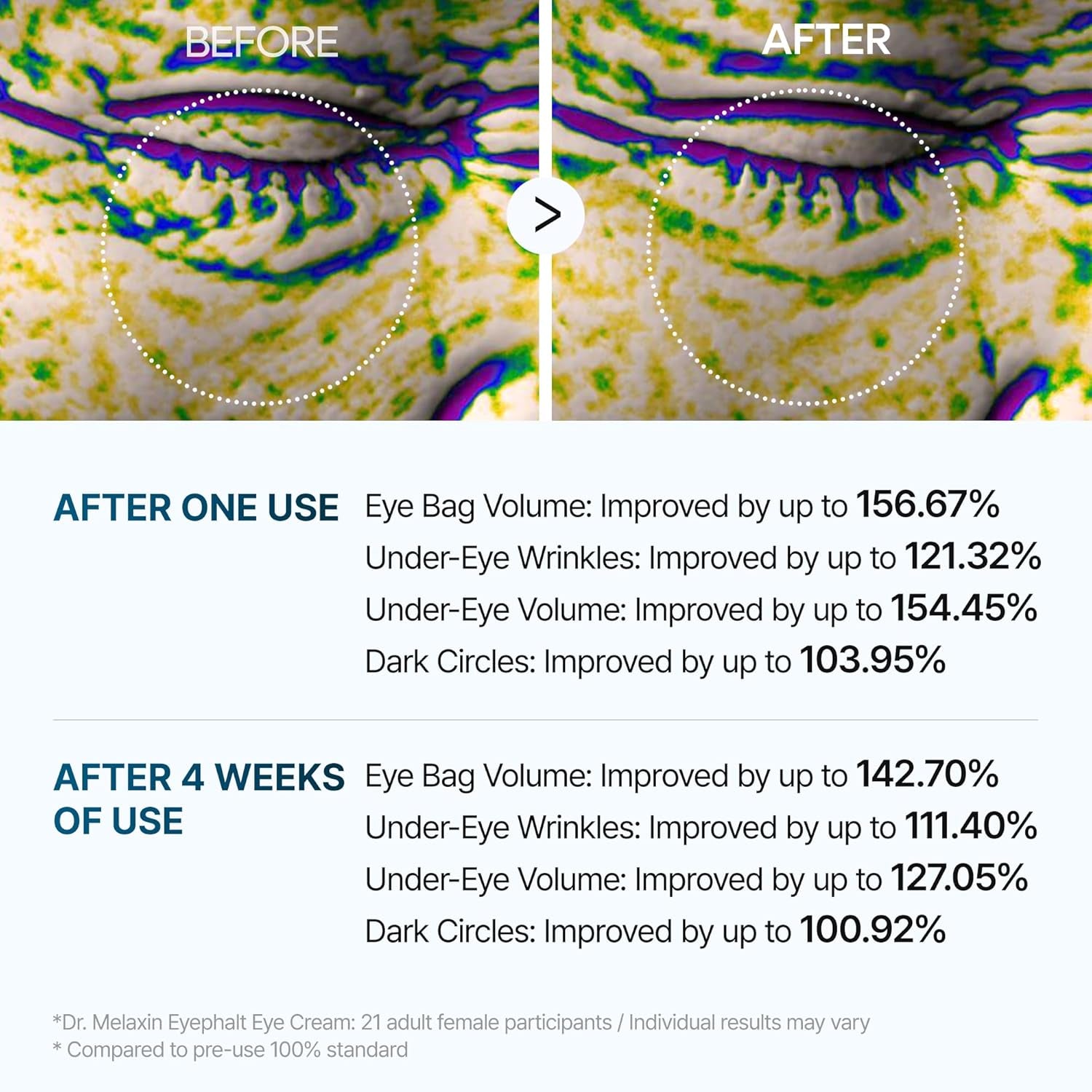 Dr.Melaxin Eyephalt Eye Bag Cream – Intensive Under-Eye Treatment for Puffiness & Dark Circles | 10ml | Korean Skincare