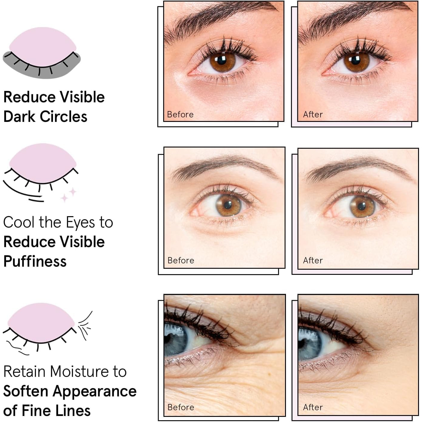 Grace & Stella Gold Gel Eye Patches – Award-Winning Under-Eye Masks for Dark Circles, Puffiness & Eye Bags | Vegan | 24 Pairs