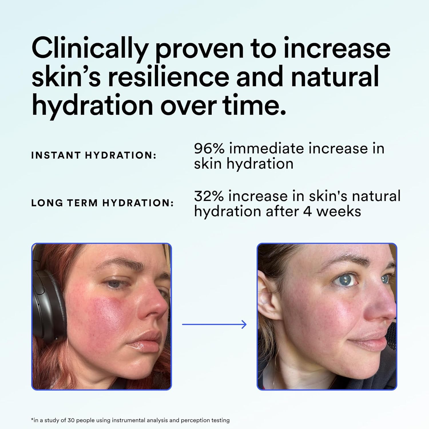 Experiment Super Saturated Ultra Hydrating Barrier Serum - 30% Glycerin, Polyglutamic Acid + Prickly Pear for Intensive Moisture, Plump + Dewy Skin, 1.35 FL OZ - Hydrating Serum for All Skin Types