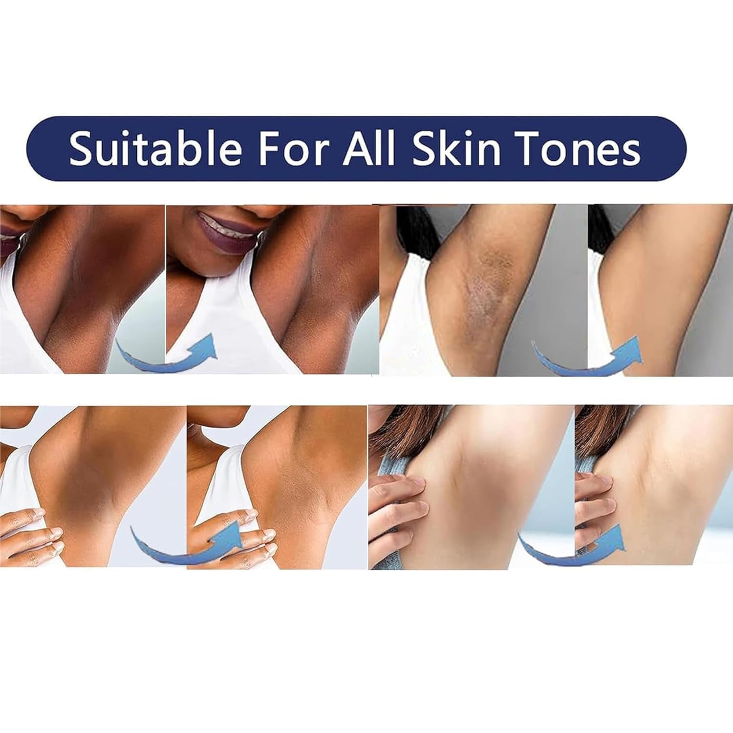 Gukei Intimate Brightening Gel – Niacinamide, Arbutin & Vitamin C for Dark Spot Correction | Underarms, Inner Thighs & Bikini Line | 30ml