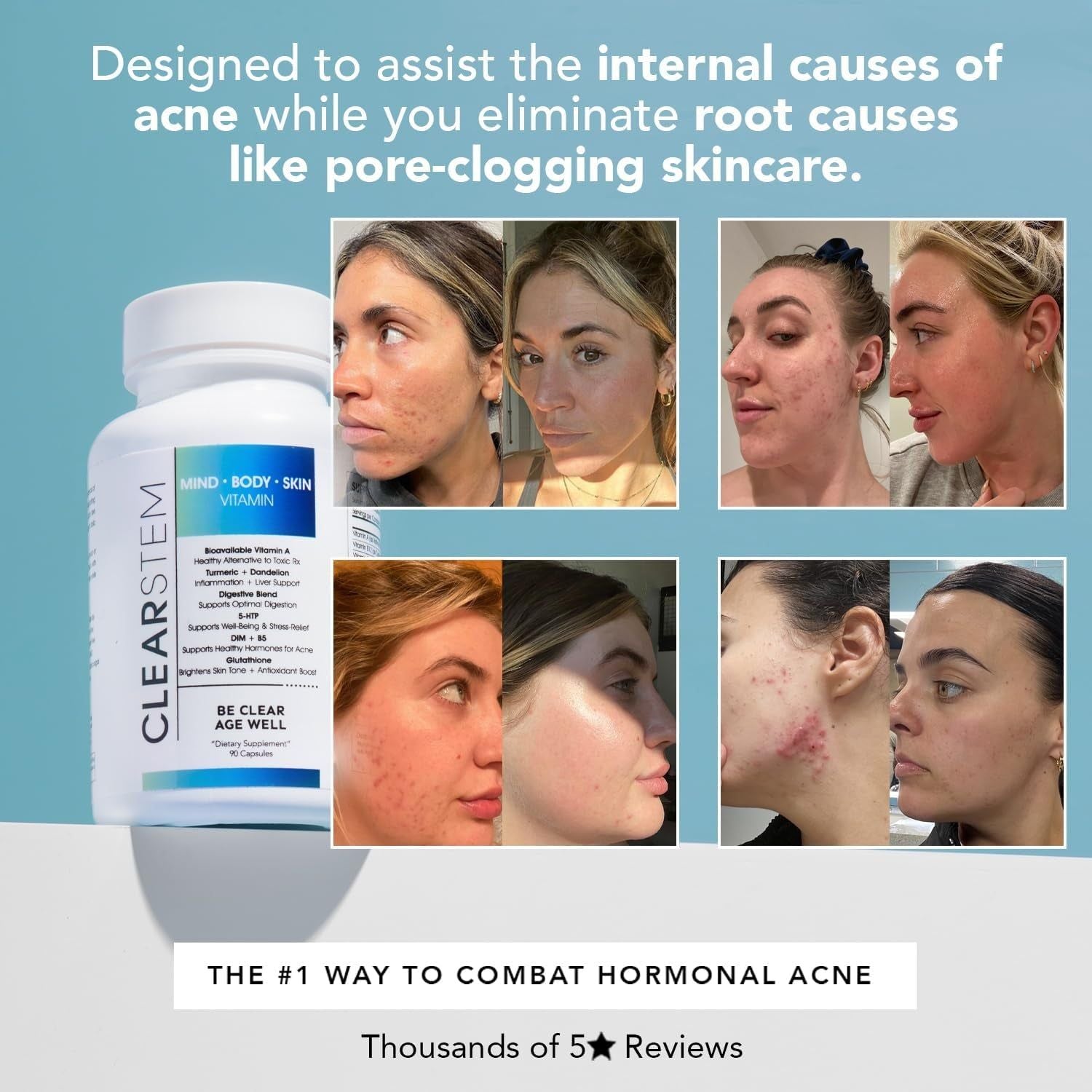 CLEARSTEM MIND·BODY·SKIN® Vitamin (with 5-HTP) – 90 Capsules | Hormonal Acne Relief, Mood Support & Clear Skin from Within