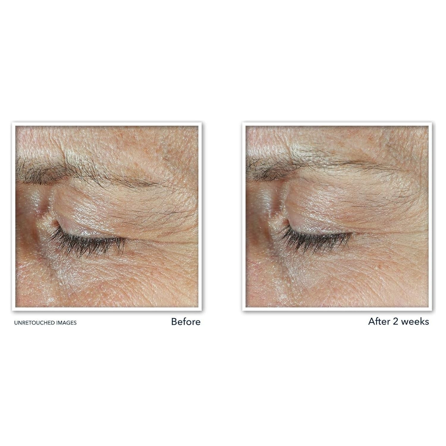 RoC + Derm Correxion Dual Eye Cream + Advanced Retinol + Peptides – 2 x 10ml | 2-in-1 Eye Lift System for Upper Lids & Under Eyes