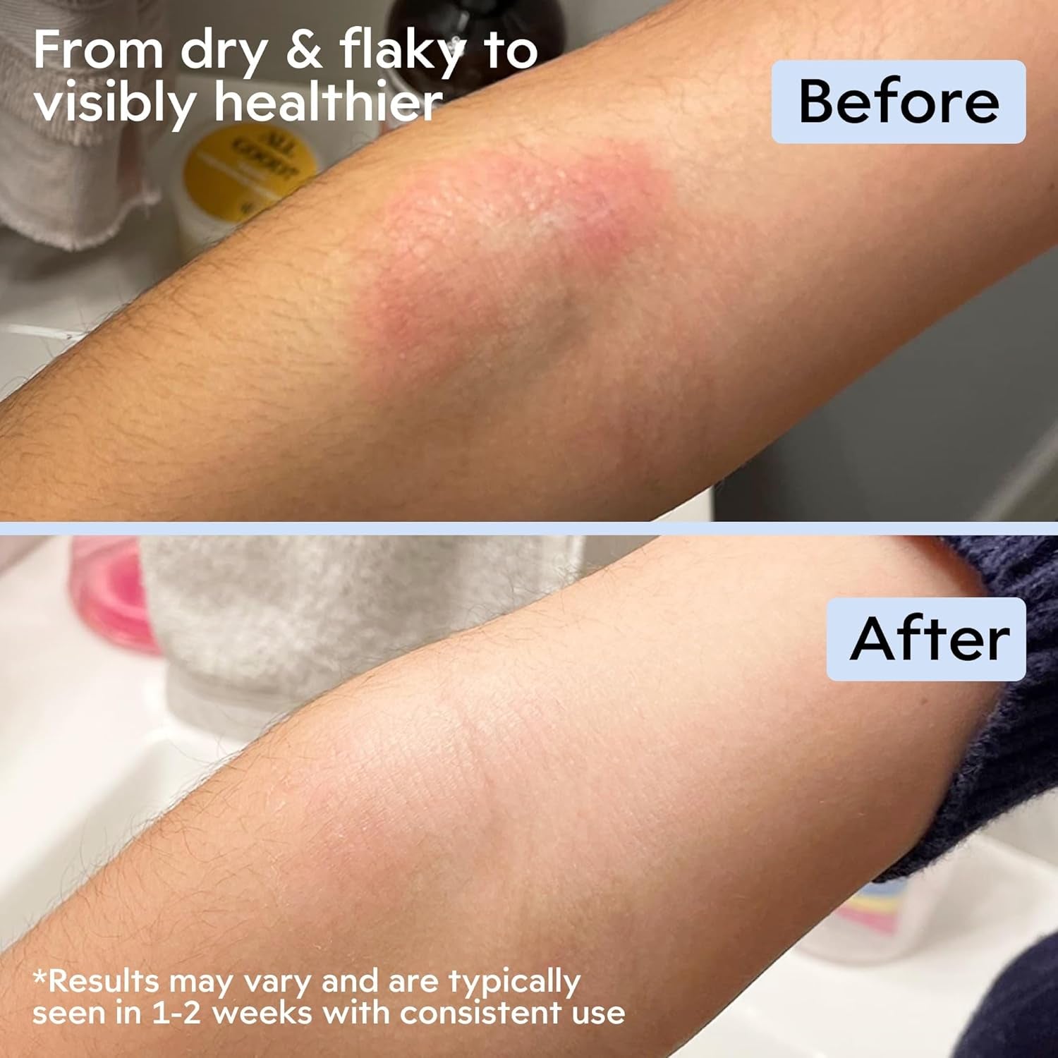 Clearbody Organics Manuka Honey Cream – 120ml | Soothing Eczema Cream with Colloidal Oatmeal | Deep Hydration for Dry & Itchy Skin