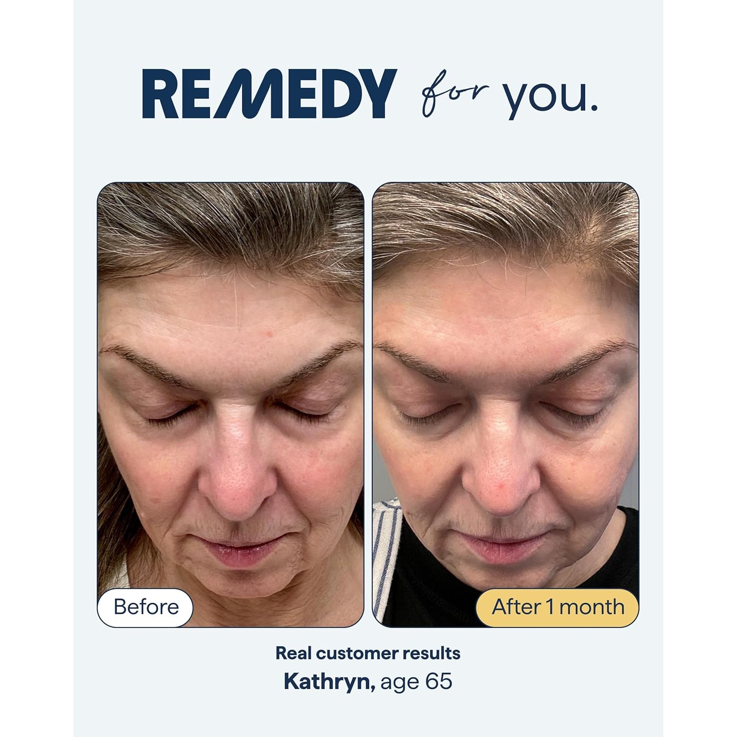 Remedy for Healthy Aging - Retinal, Resveratrol, Glycolic Acid - 30ml