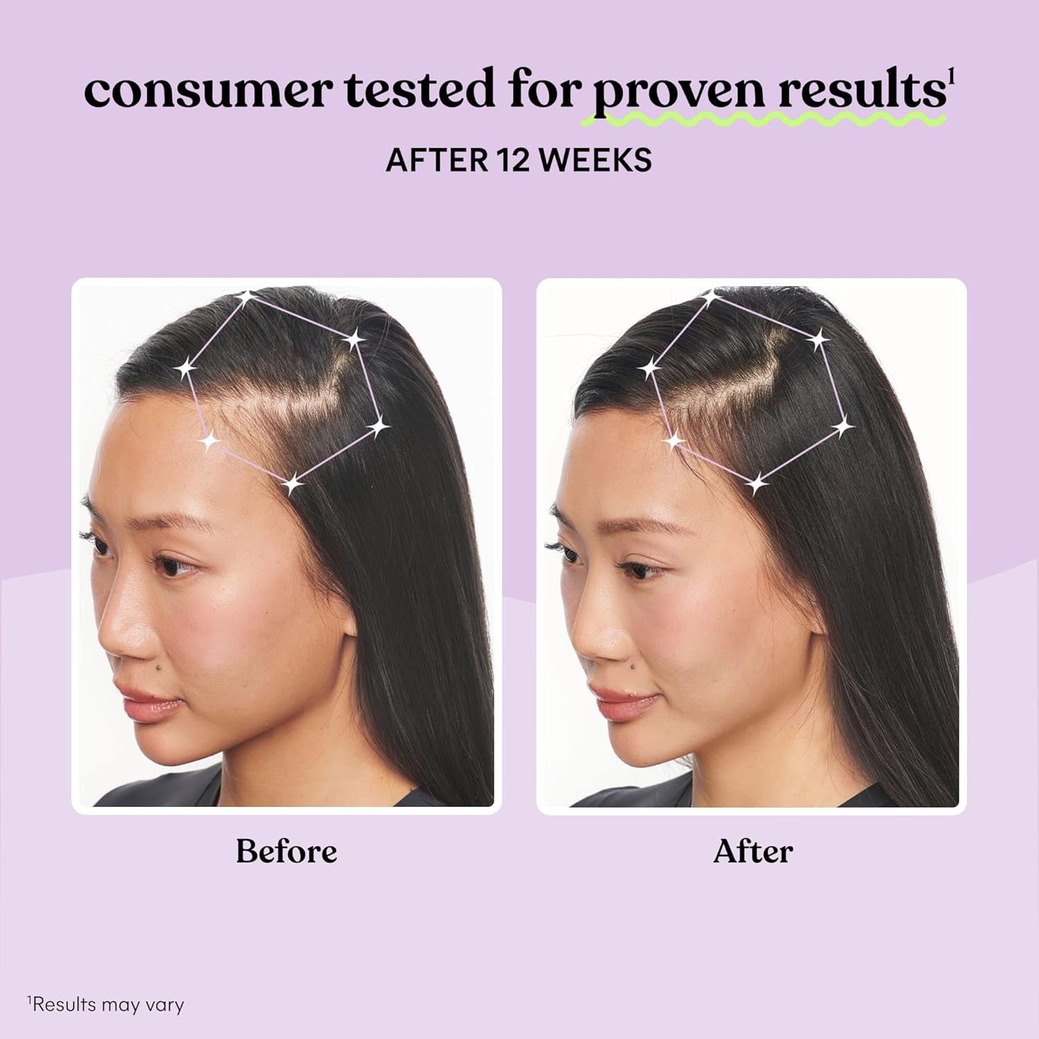 Grow Hair Growth Supplement for Women, Clinically Proven Keratin Complex for Visibly Thicker Hair and Scalp Coverage, Reduced Shedding, Nourish Thinning Hair - 1 Month Supply