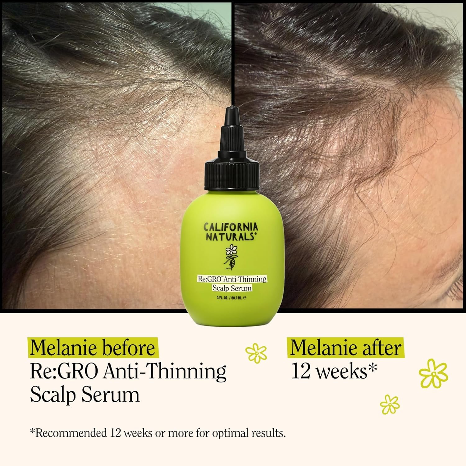 California Naturals Re:Gro Women's Scalp Serum – 5% Capixyl, Biotin & Rosemary Oil for Thicker Hair | 90ml