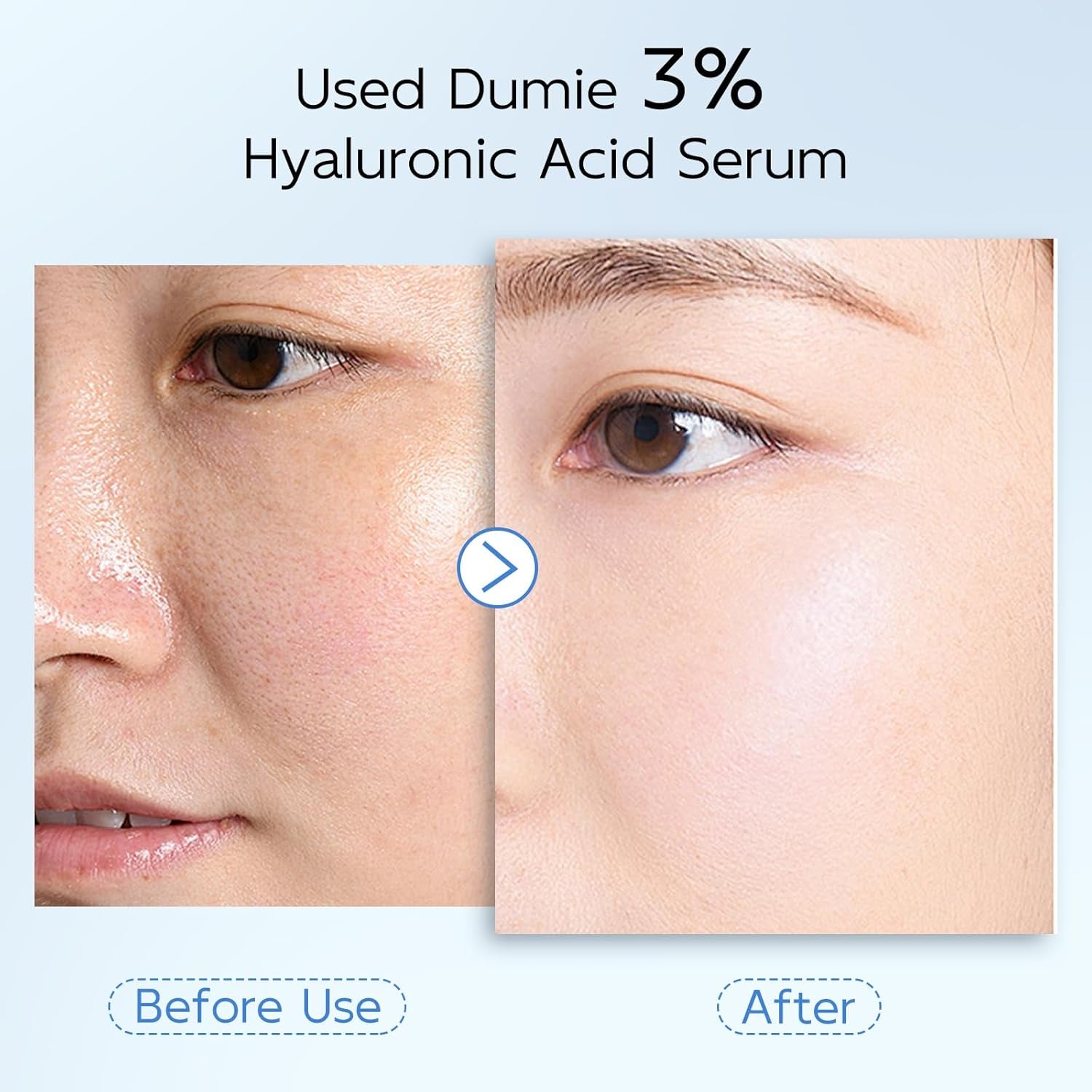3% Hyaluronic Acid Serum for Face, Anti-Aging Hydrating Serum with 20,000 Ppm Ceramide NP & 10,000Ppm Acetyl Hexapeptide-8, Korean Skincare Ultra Hydrating Serum, Turm Skin/Sensitive Skin(1.5 Ml*30)