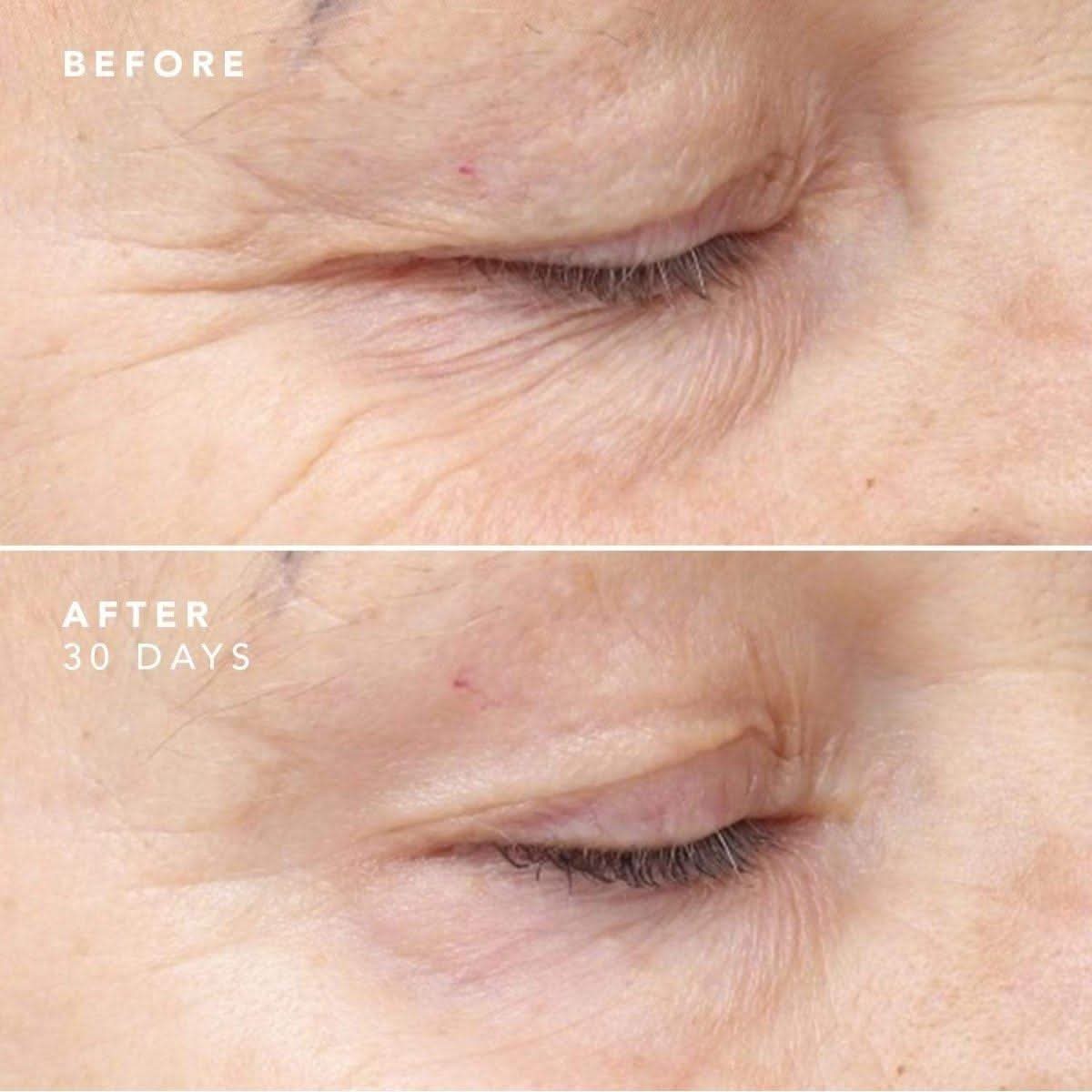 BIOEFFECT 30 Day Treatment 3 x 5ml - Glam Global UKBIOEFFECT