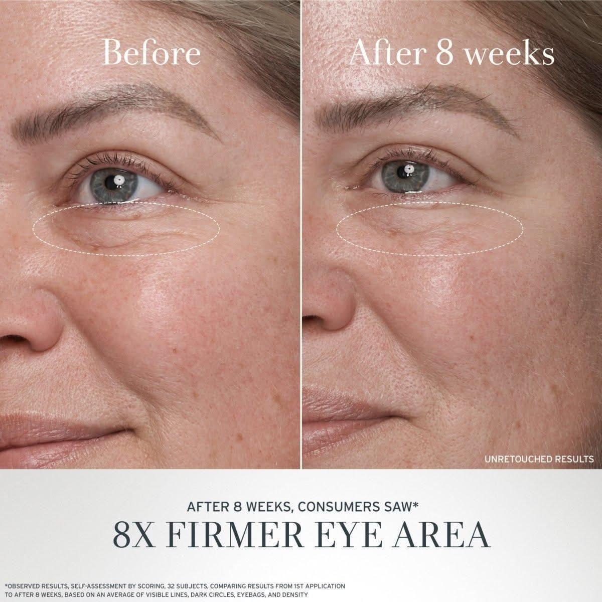 Fresh Black Tea Anti - Aging Eye Cream - 50ml - Glam Global UKFresh