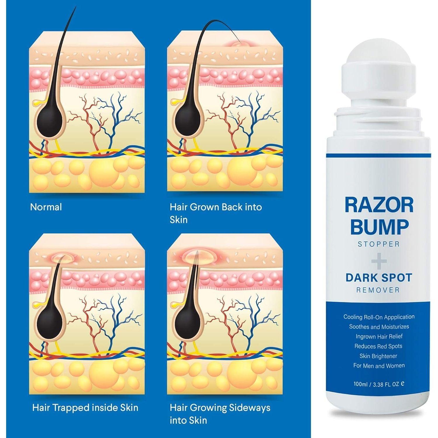 Sielkin Razor Bump Stopper + Dark Spot Remover – 100ml | Smooth, Clear & Even-Toned Skin