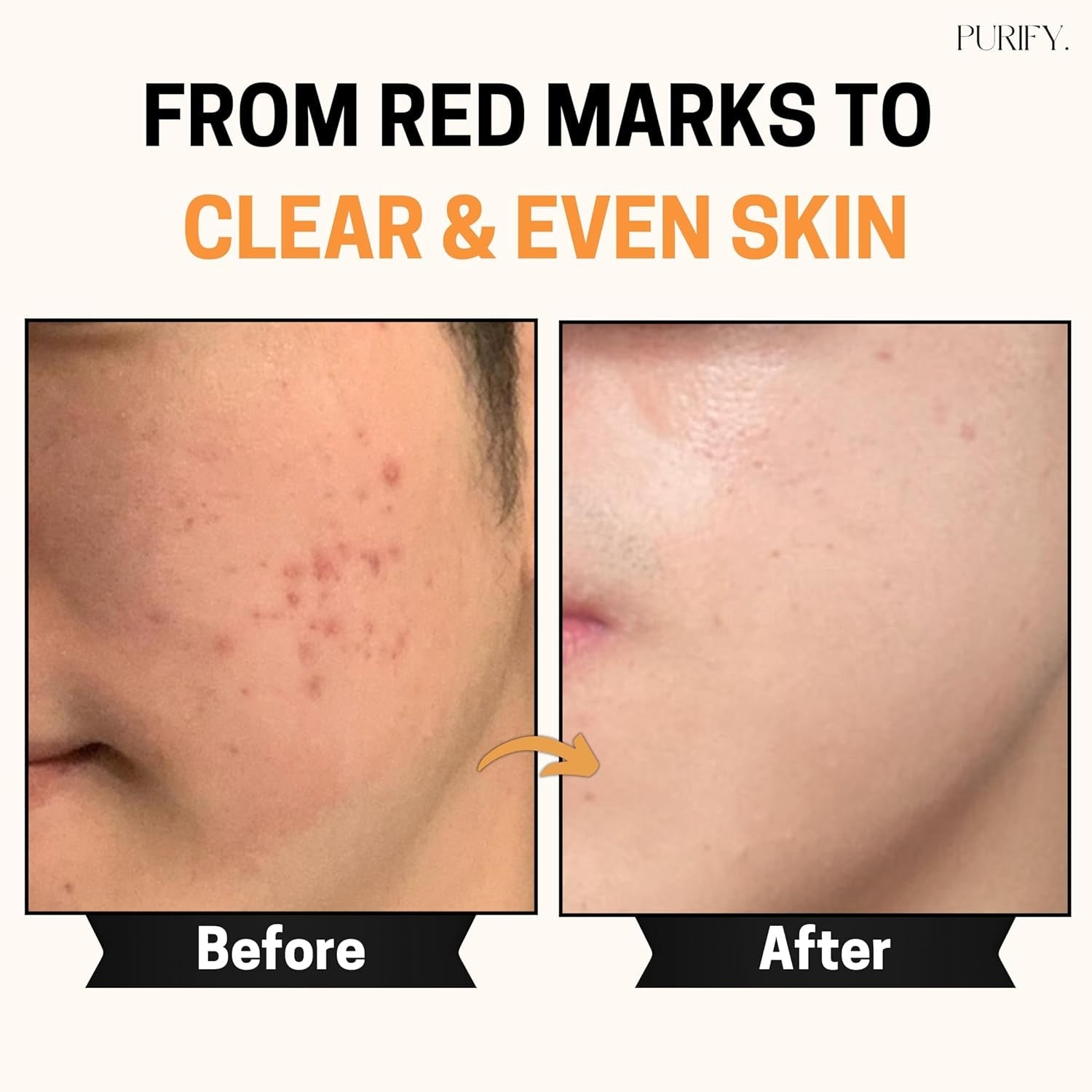 Purify. Vitamin C Serum – 30ml | Brightening, Anti-Aging & Antioxidant Protection with 3-O-Ethyl Ascorbic Acid