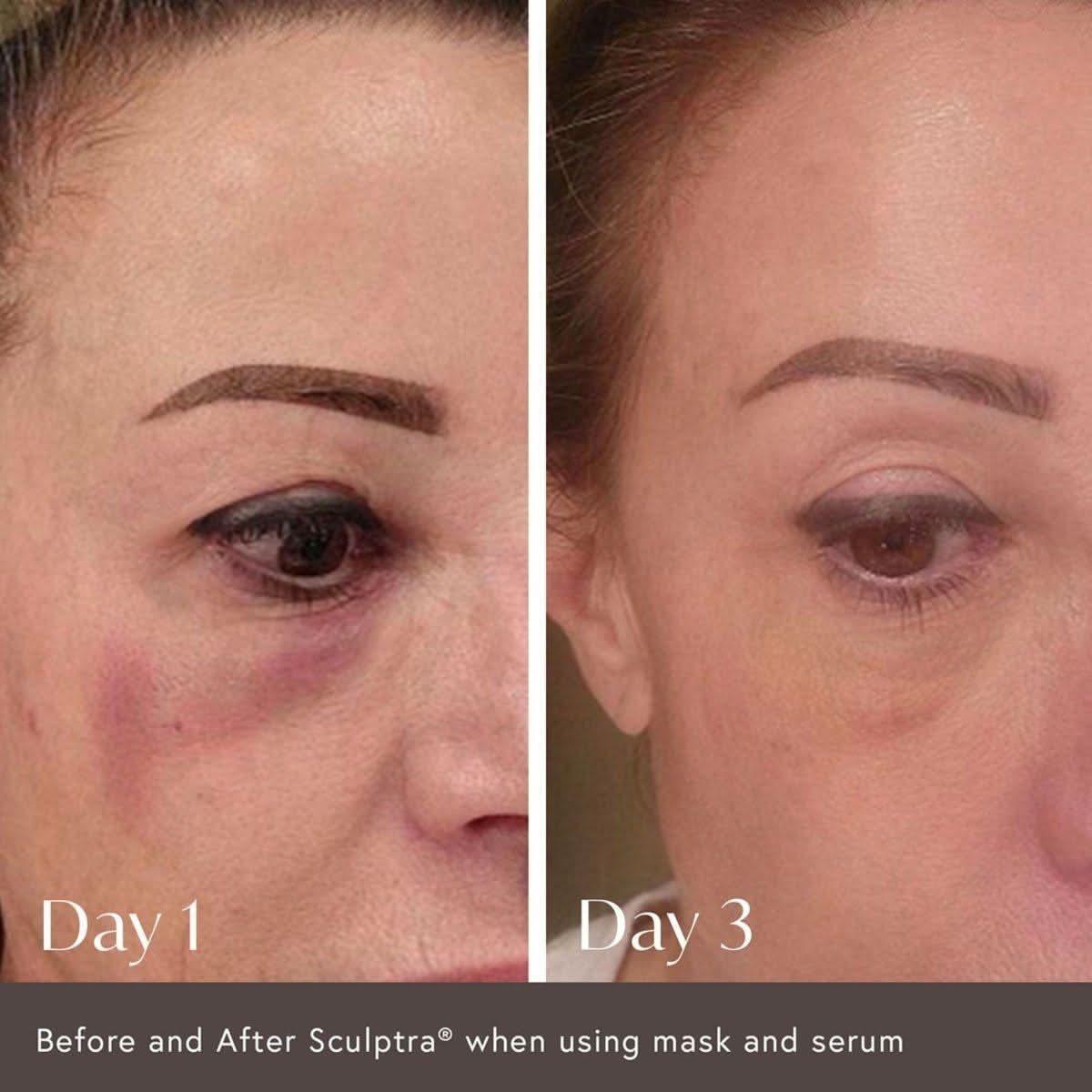 Viktor Michael Ciao For Now Post Injection Care Mask - 50ml - Glam Global UKViktor Michael