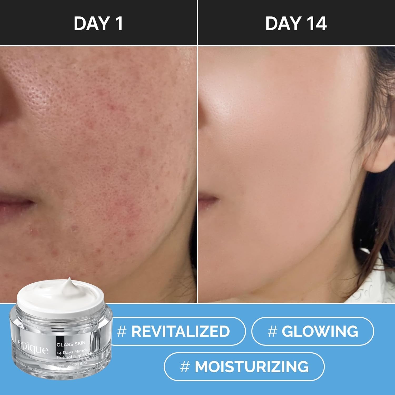 Lepique Retinol Night Cream 1.69Oz - No.1 Korean Premium Overnight Repair Cream for Face and Neck - Collagen, Centella, Hyaluronic Acid - anti Aging, Acne, Moisturizer, Face Cream, Hydrating, Firming