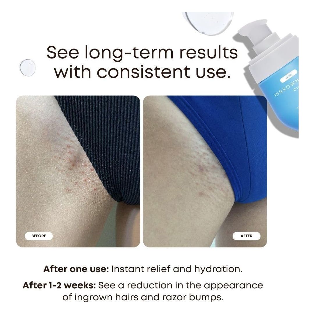 Bushbalm Ingrown Hair Oil (Nude) – 30ml | Soothes, Softens & Prevents Razor Bumps
