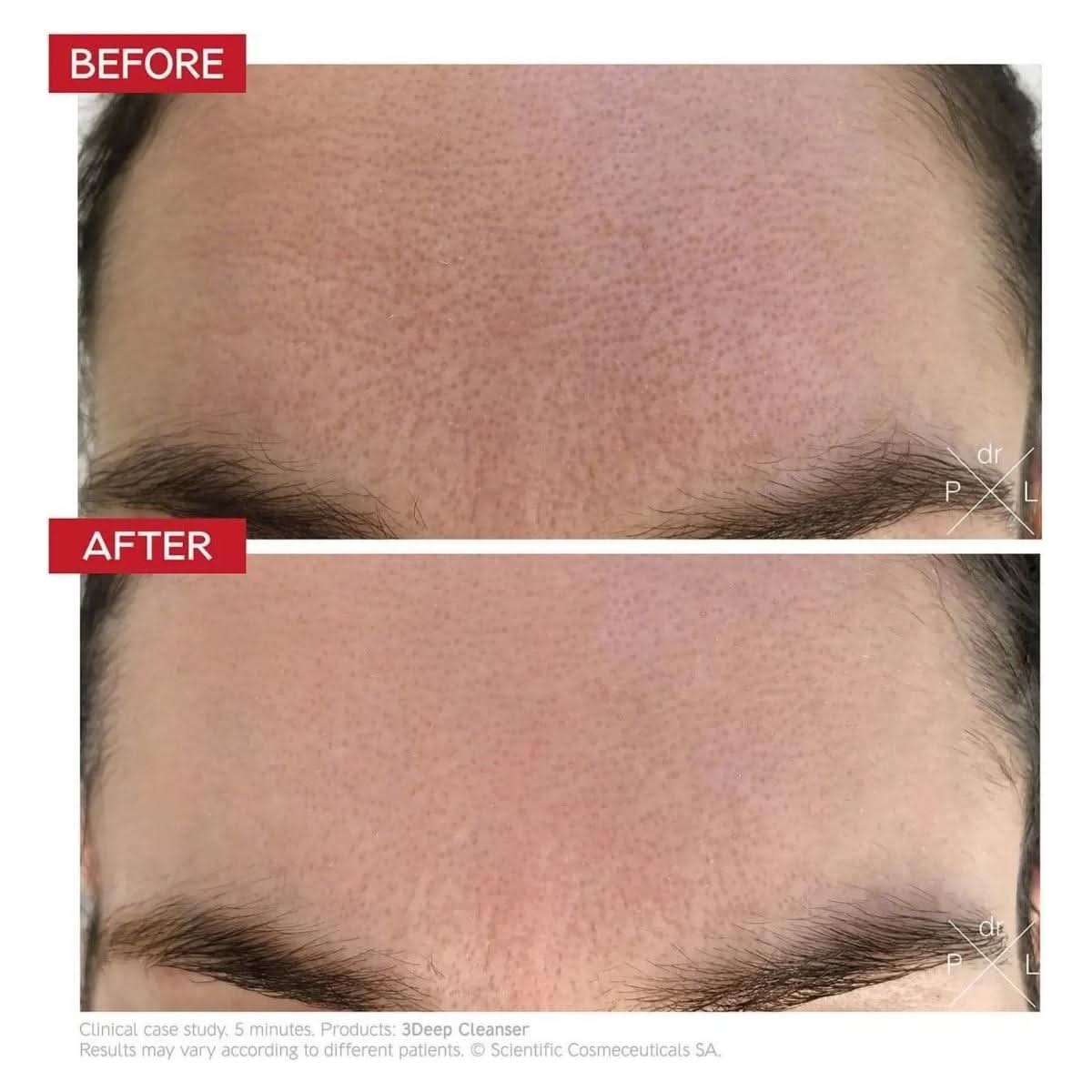 Dr LEVY Switzerland | 3Deep Cell Renewal Micro - Resurfacing Cleanser - Glam Global UKDr Levy Switzerland