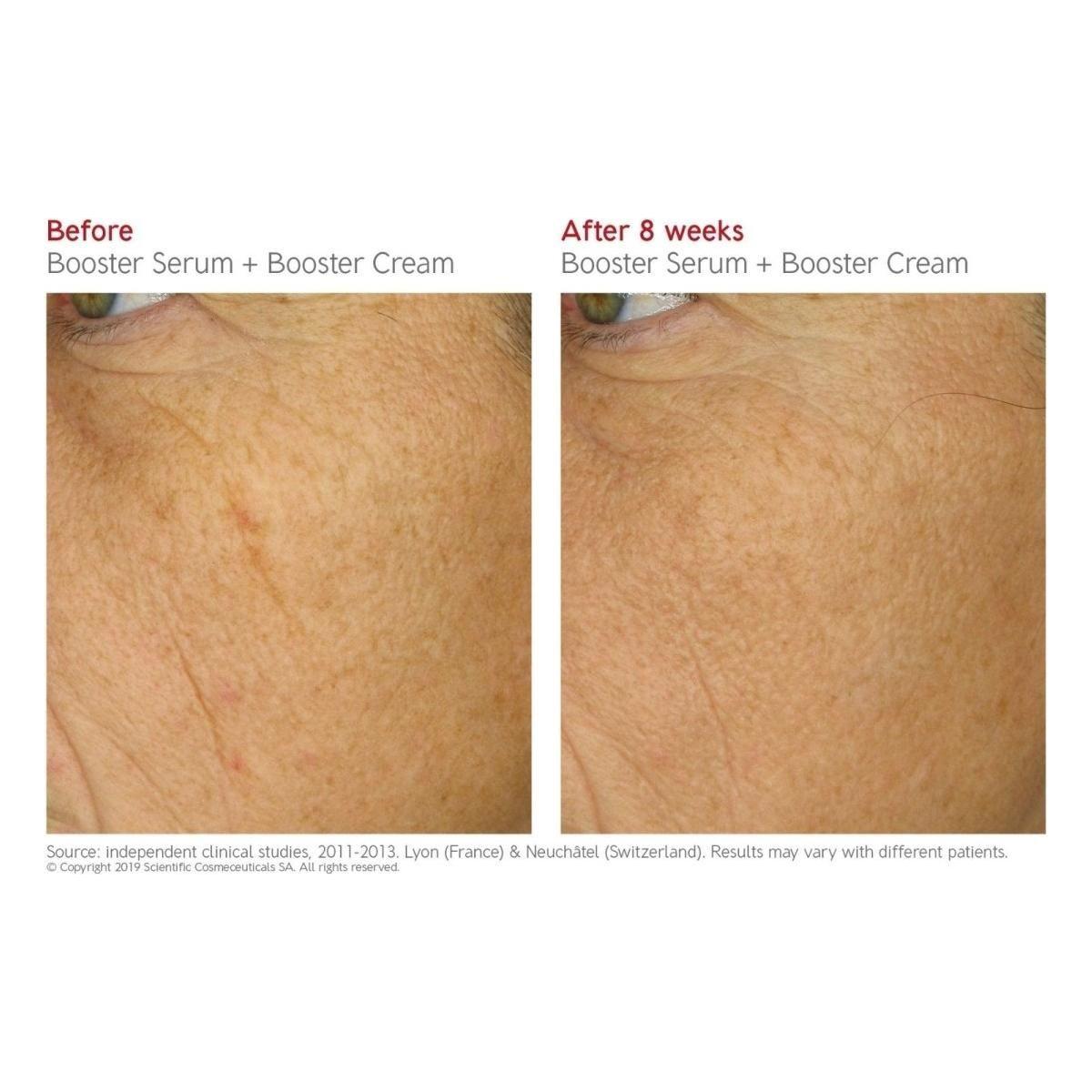 Dr LEVY Switzerland | Booster Serum - Glam Global UKDr Levy Switzerland