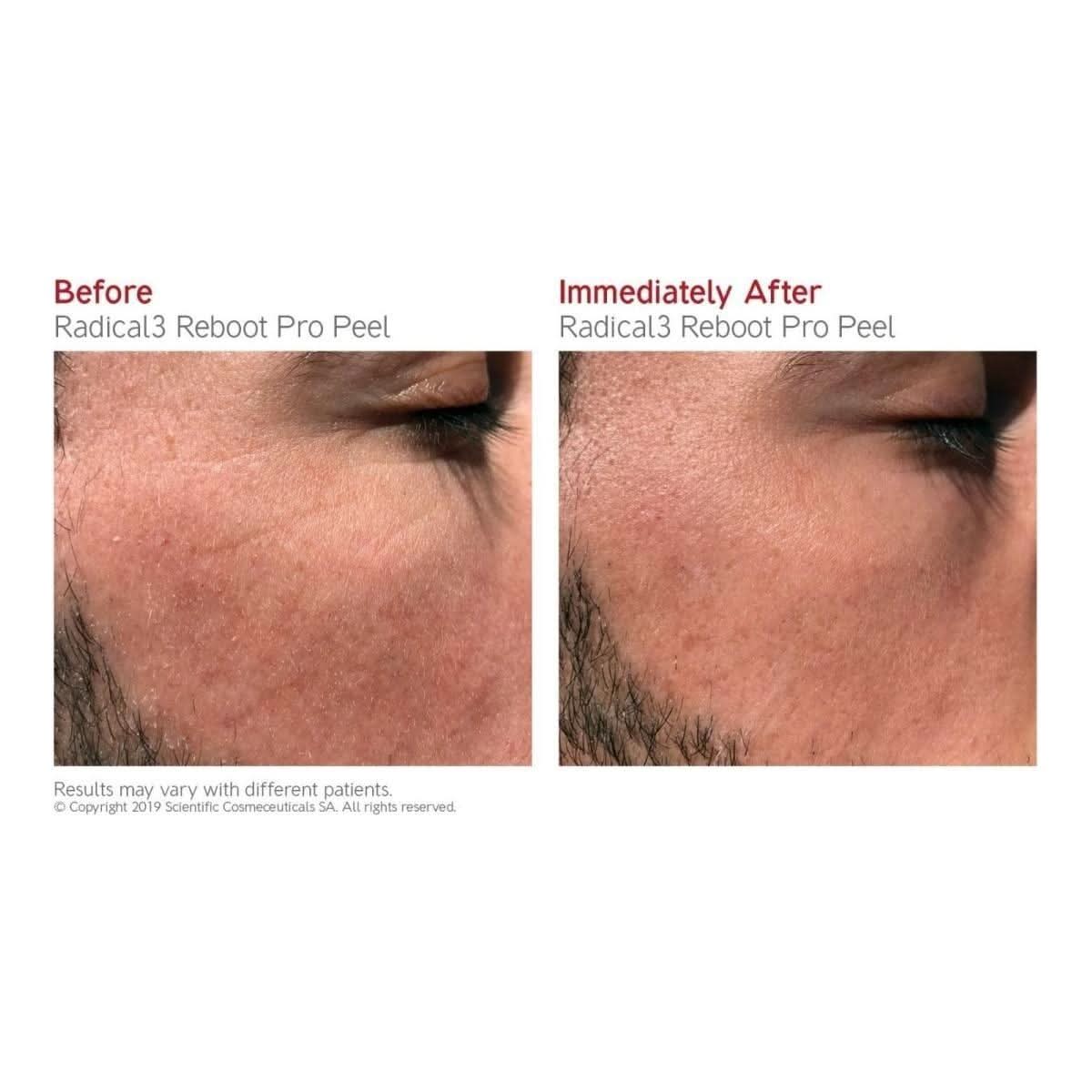 Dr LEVY Switzerland | Radical3 Reboot Pro Peel - Glam Global UKDr Levy Switzerland