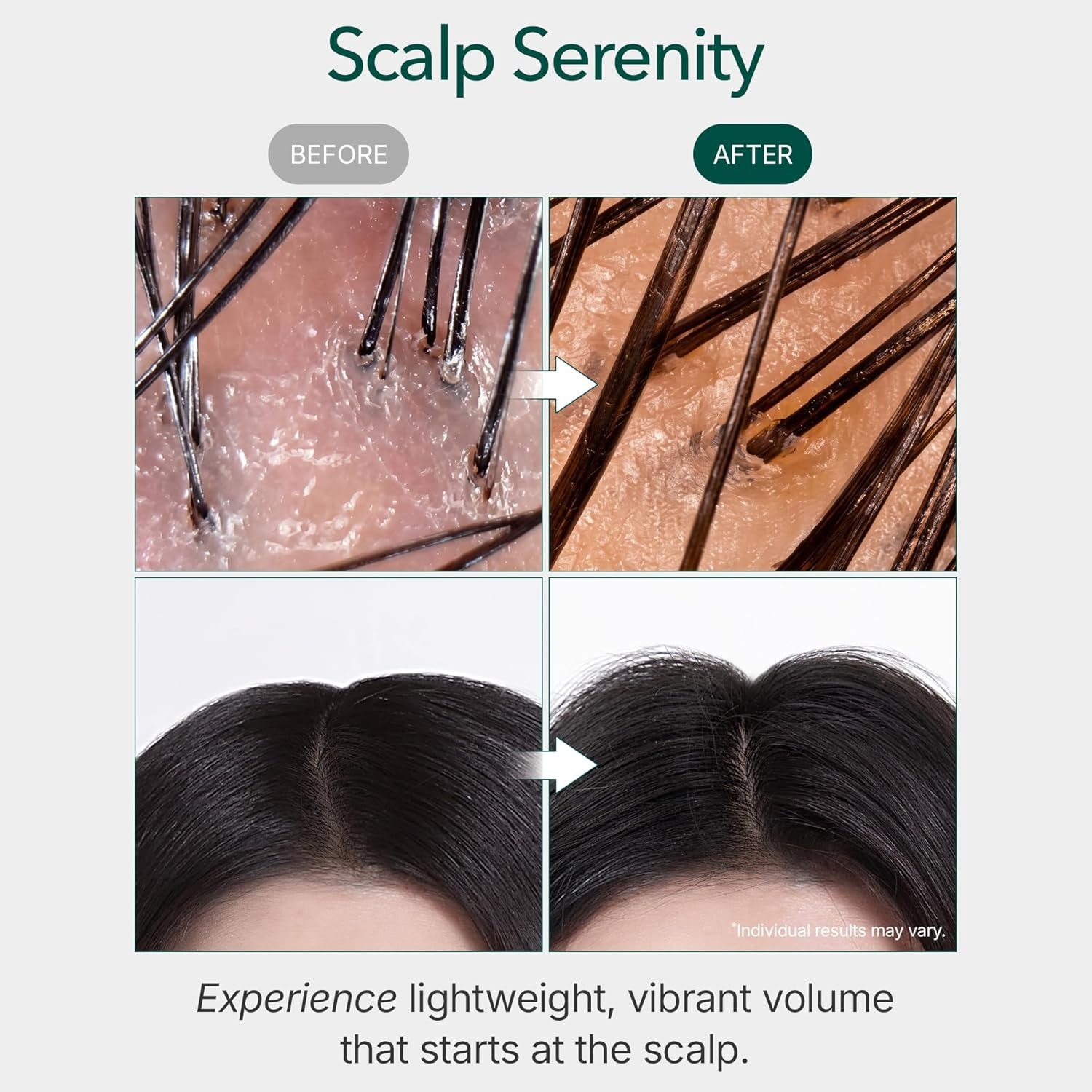 Vivelab Rosemary & Multi-Peptide Hair Growth Serum - Targeted Roll on Scalp Treatment for Thicker Hair Density, Clinically Tested for Healthier Hairline & Brows