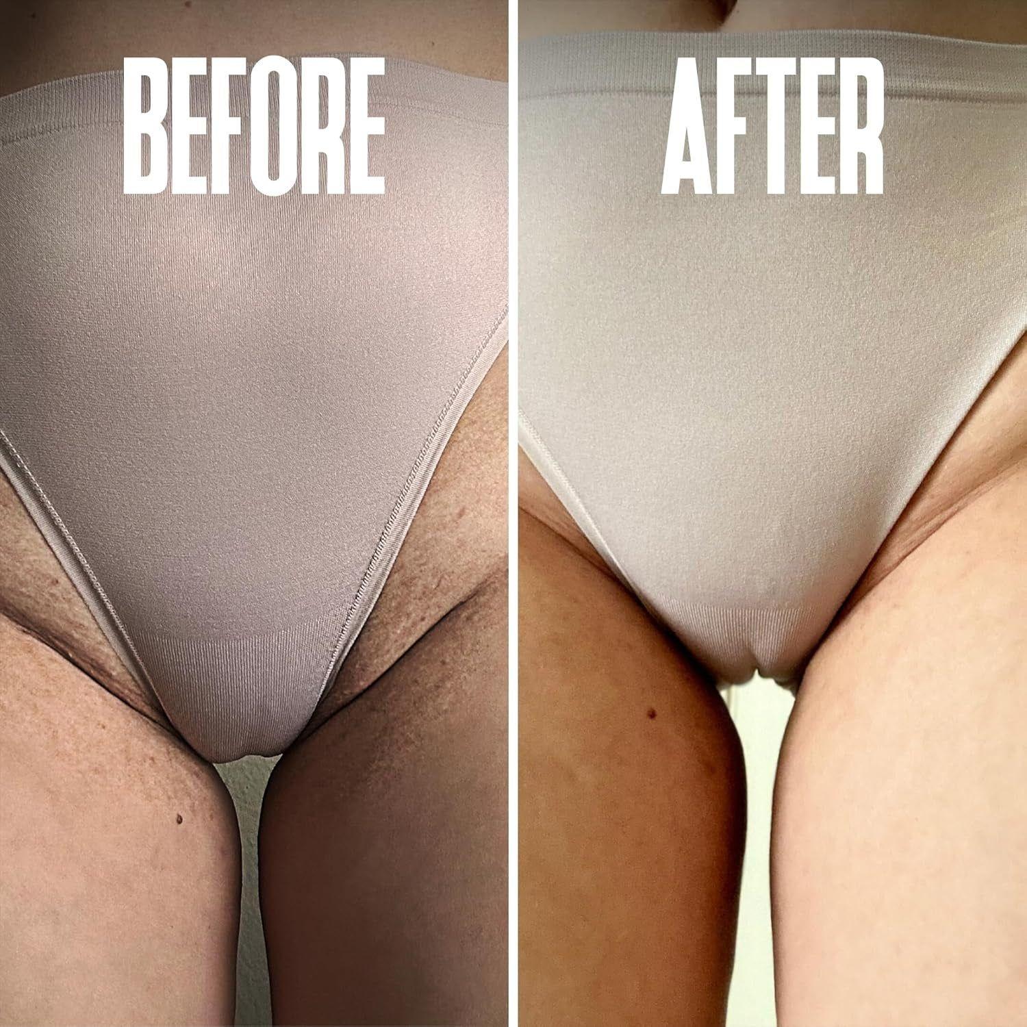 Divine Derriere Ingrown Hair Pads – 50 Pads | Exfoliating Razor Bump & Ingrown Hair Treatment