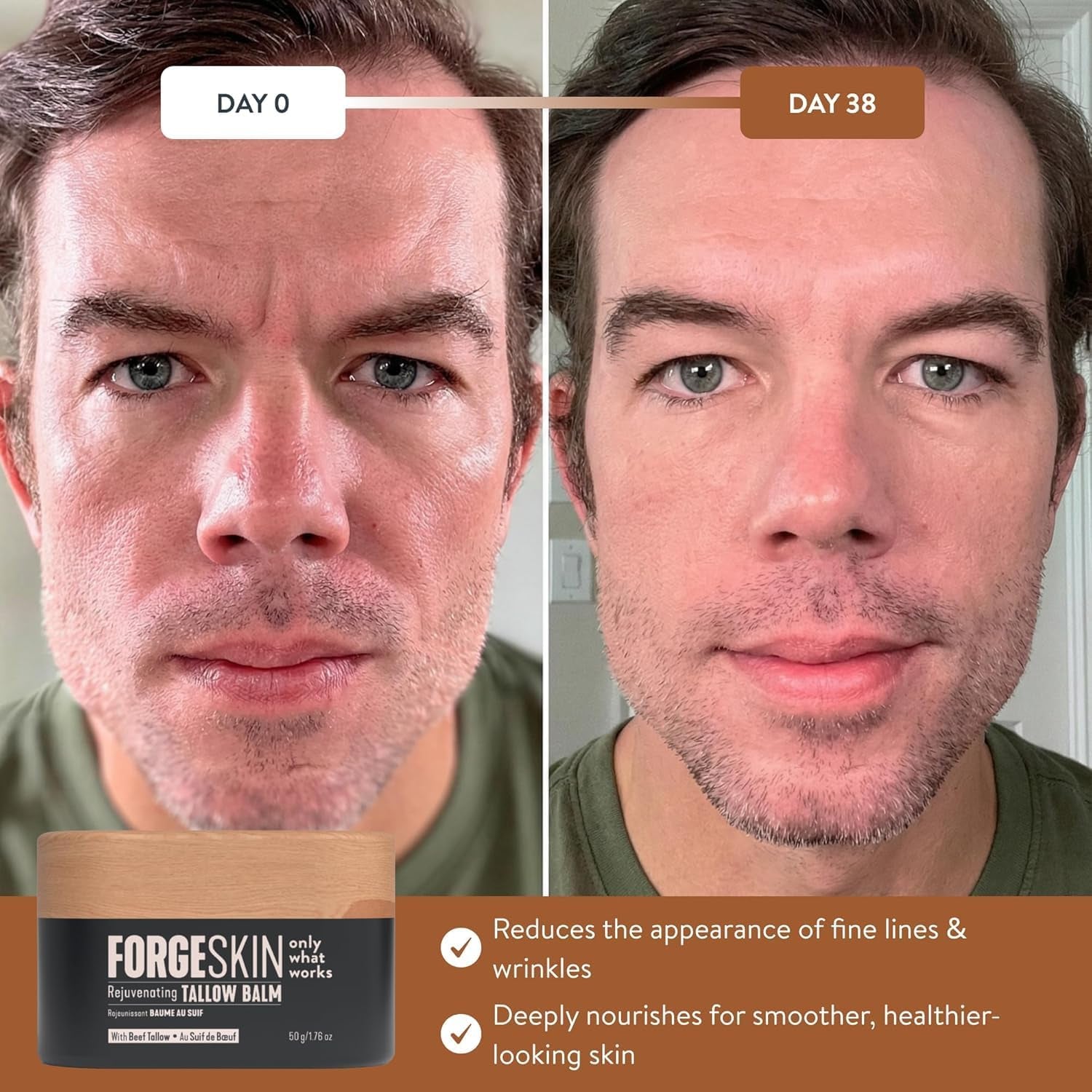 Forge Skin Wrinkle Defence Beef Tallow Balm for Men – 48g | Grass-Fed Tallow & Essential Oils | Face & Body Anti-Ageing Hydration Cream