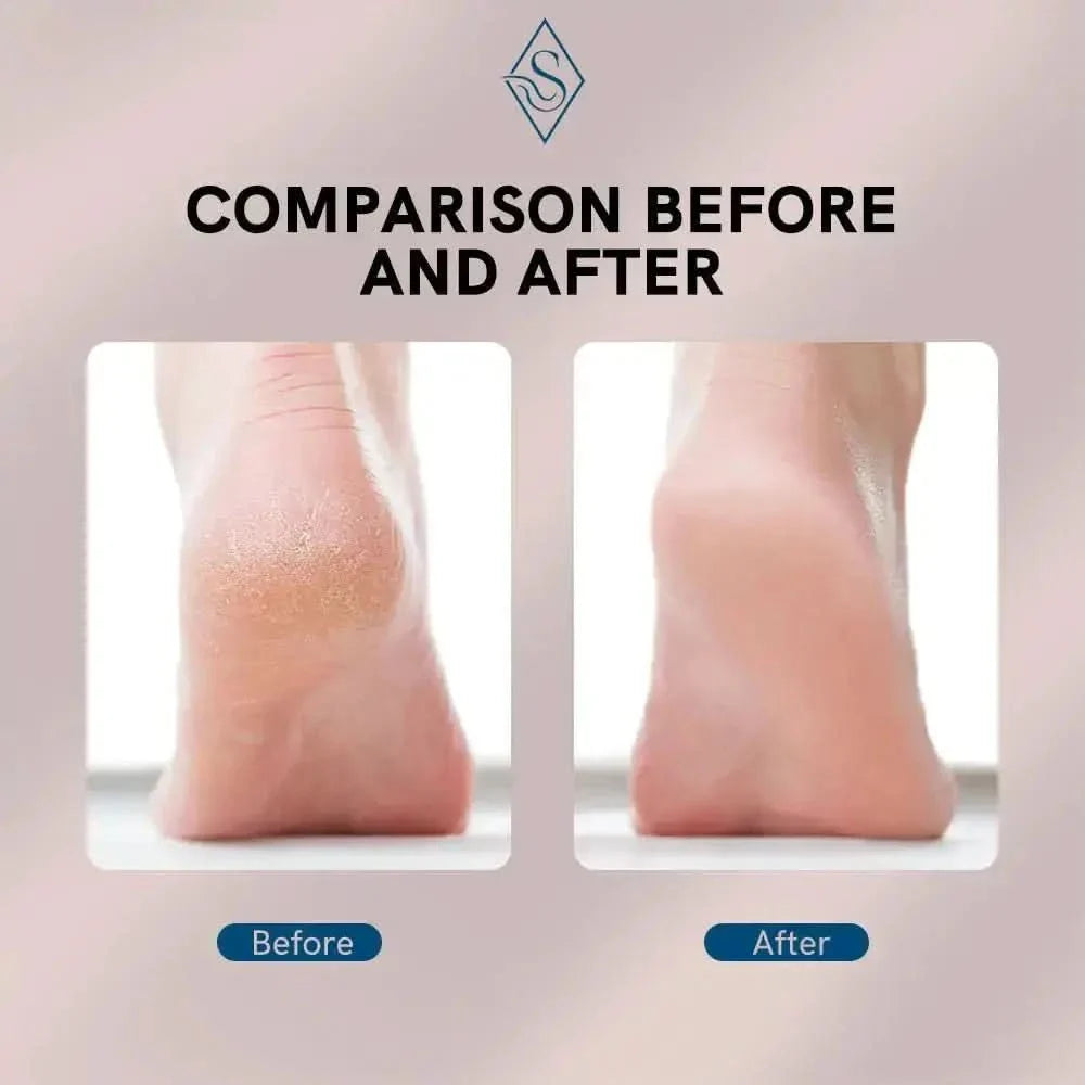 Electric Foot File for Heels – Rechargeable Grinding Tool - Glam Global UKGlam Global UK