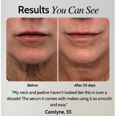 EMS Facial Toner Gel & Device – Non - Invasive Skin Toning and Rejuvenation System - Glam Global UKGlam Global UK