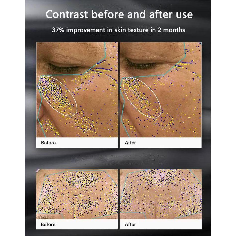 ENVIG EDGE RF beauty instrument - Glam Global UKENVIG