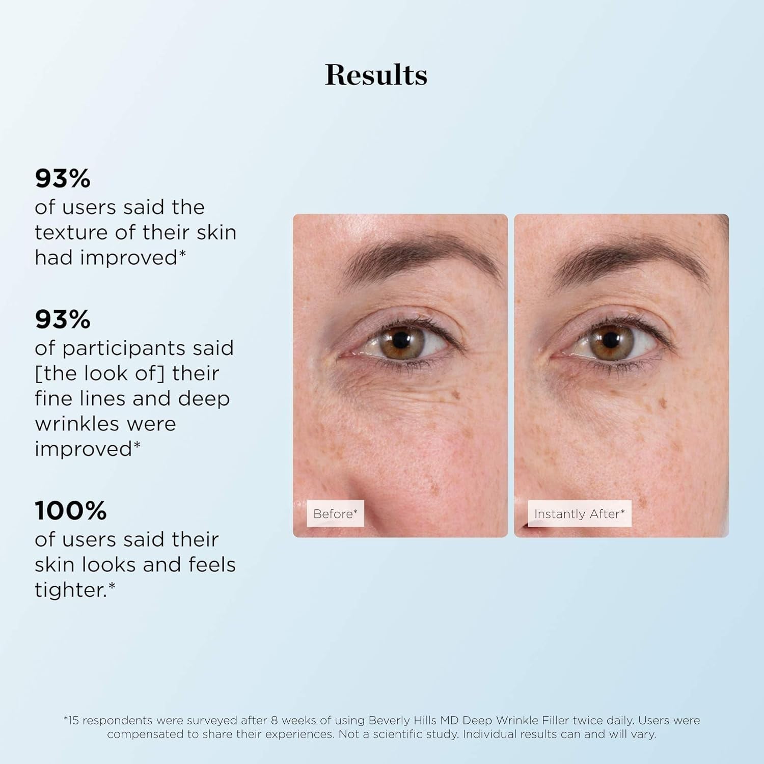 Beverly Hills MD Deep Wrinkle Filler – 4.7g | Instant Smoothing for Fine Lines & Deep Wrinkles