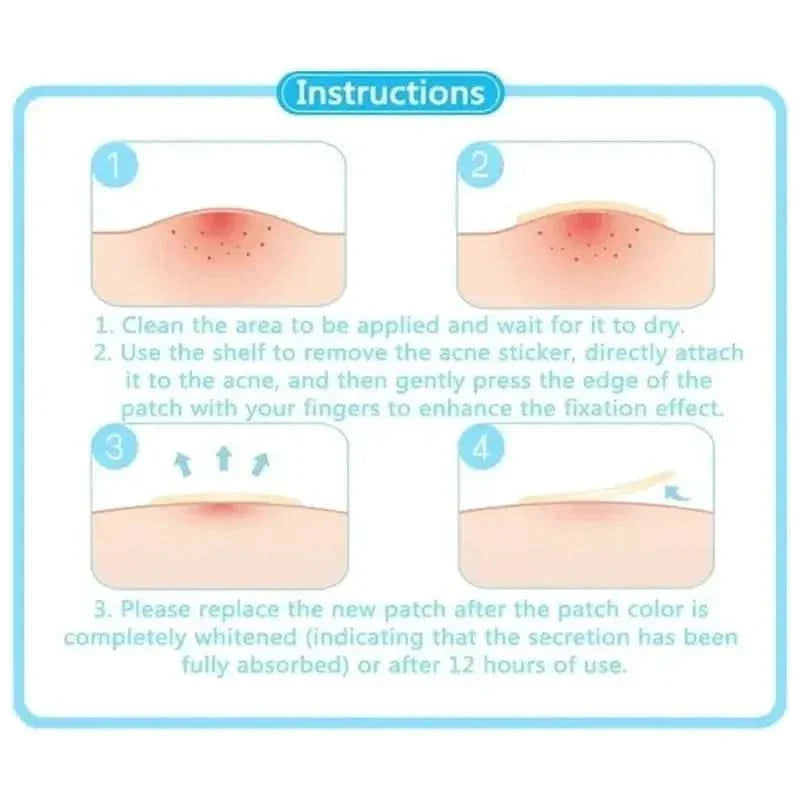 Face Acne Pimple Spot Scar Care Treatment Stickers - Glam Global UKGlam Global UK