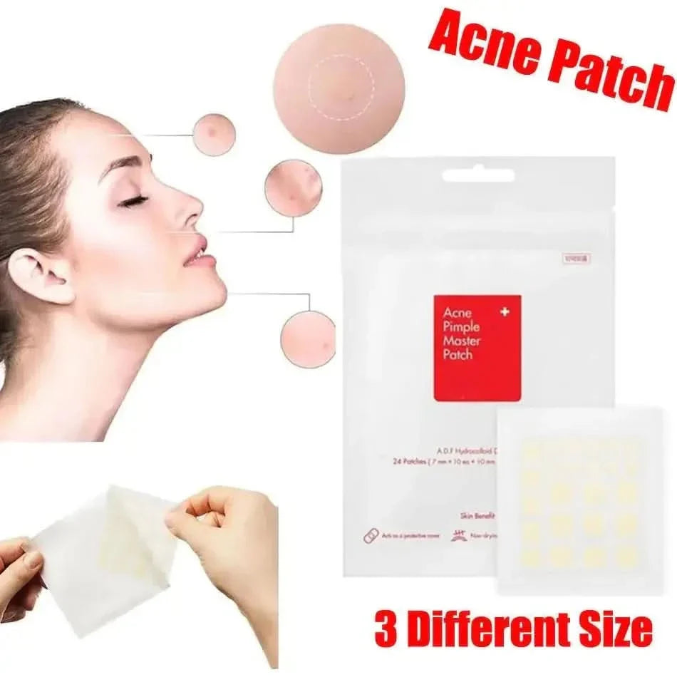 Face Acne Pimple Spot Scar Care Treatment Stickers - Glam Global UKGlam Global UK
