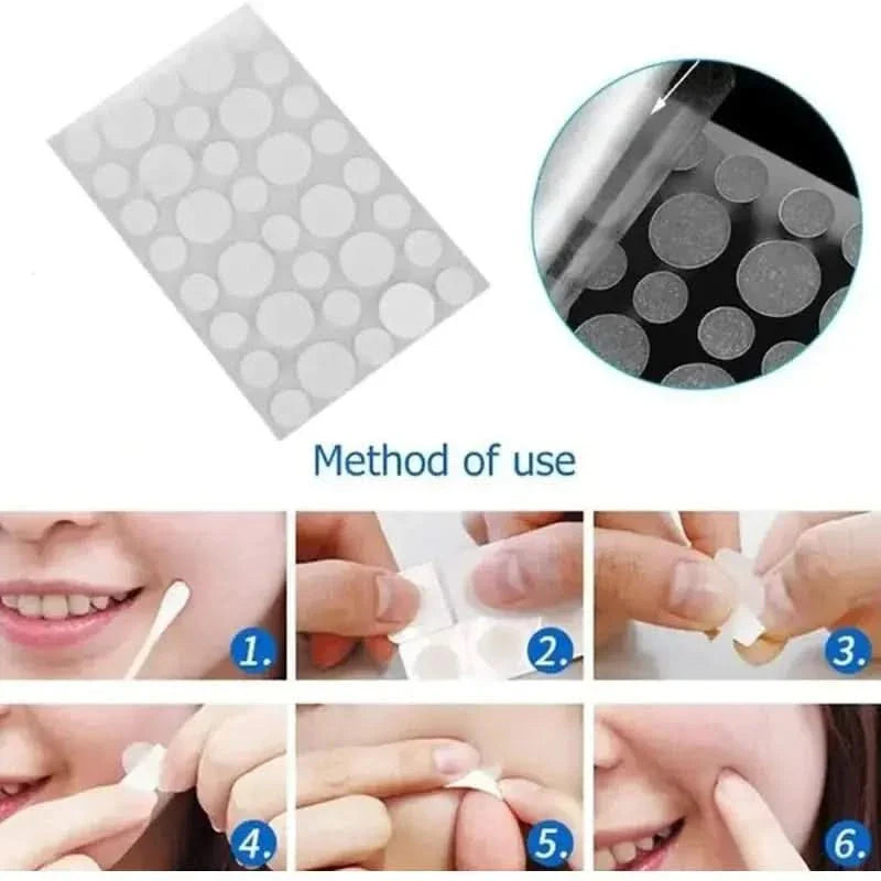 Face Acne Pimple Spot Scar Care Treatment Stickers - Glam Global UKGlam Global UK