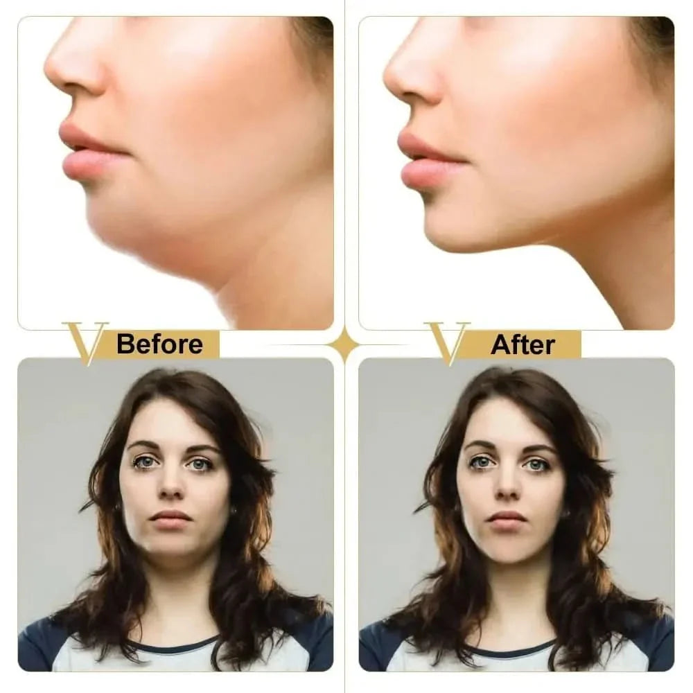 Face Lifting V Shape Slimming Mask - Glam Global UKGlam Global UK