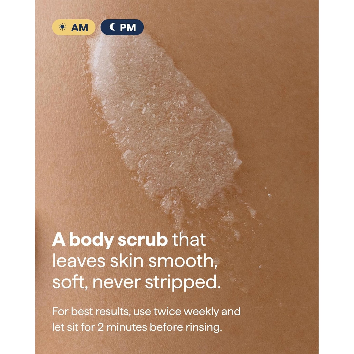 Remedy KP Exfoliating Body Scrub | Keratosis Pilaris and Chicken Skin Treatment - 200ml