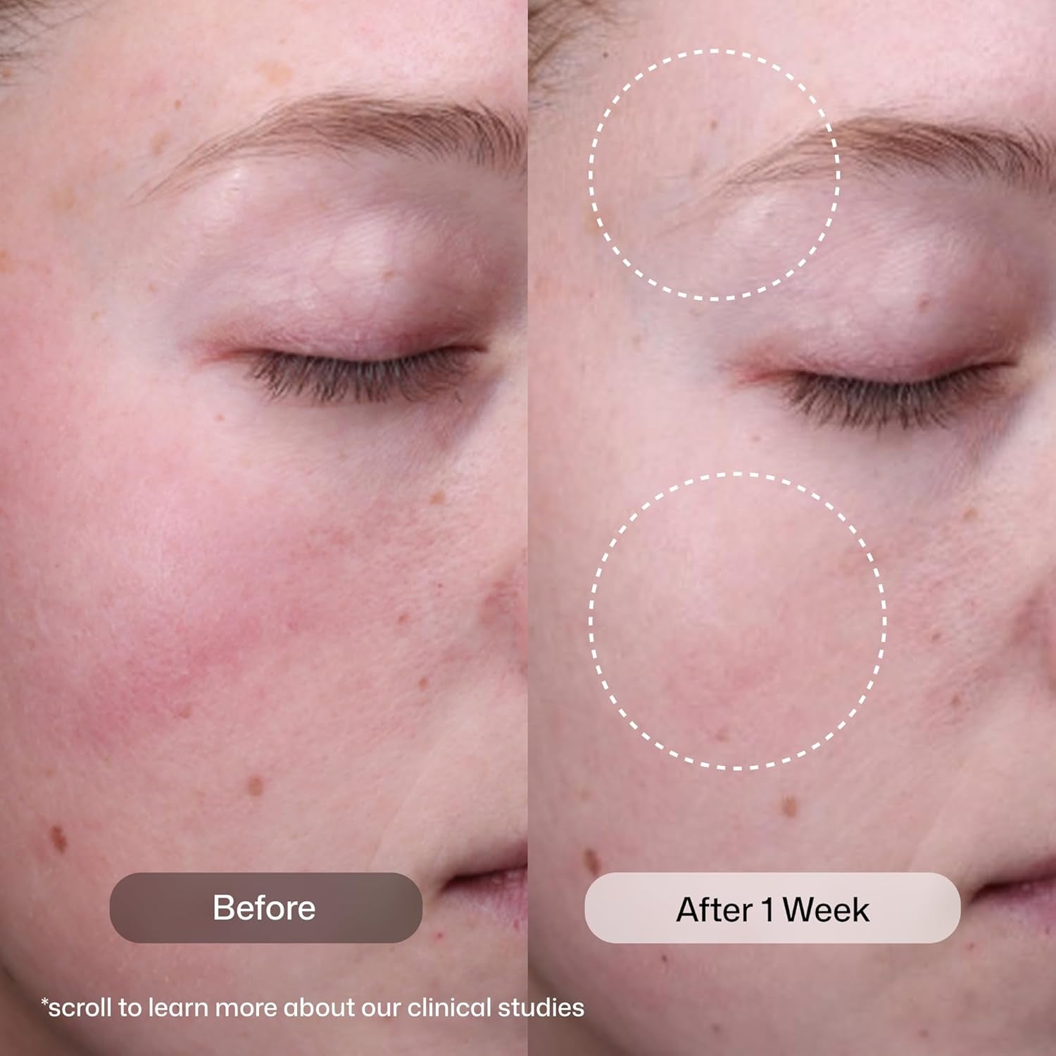 Revison Skincare Radiance+ Resurfacing Serum, Overnight AHA+BHA+PHA Exfoliating Serum with Glycolic Acid & Salicylic Acid | Smooths Uneven Texture, Clears Pores & Brightens Dull Skin, 1Oz