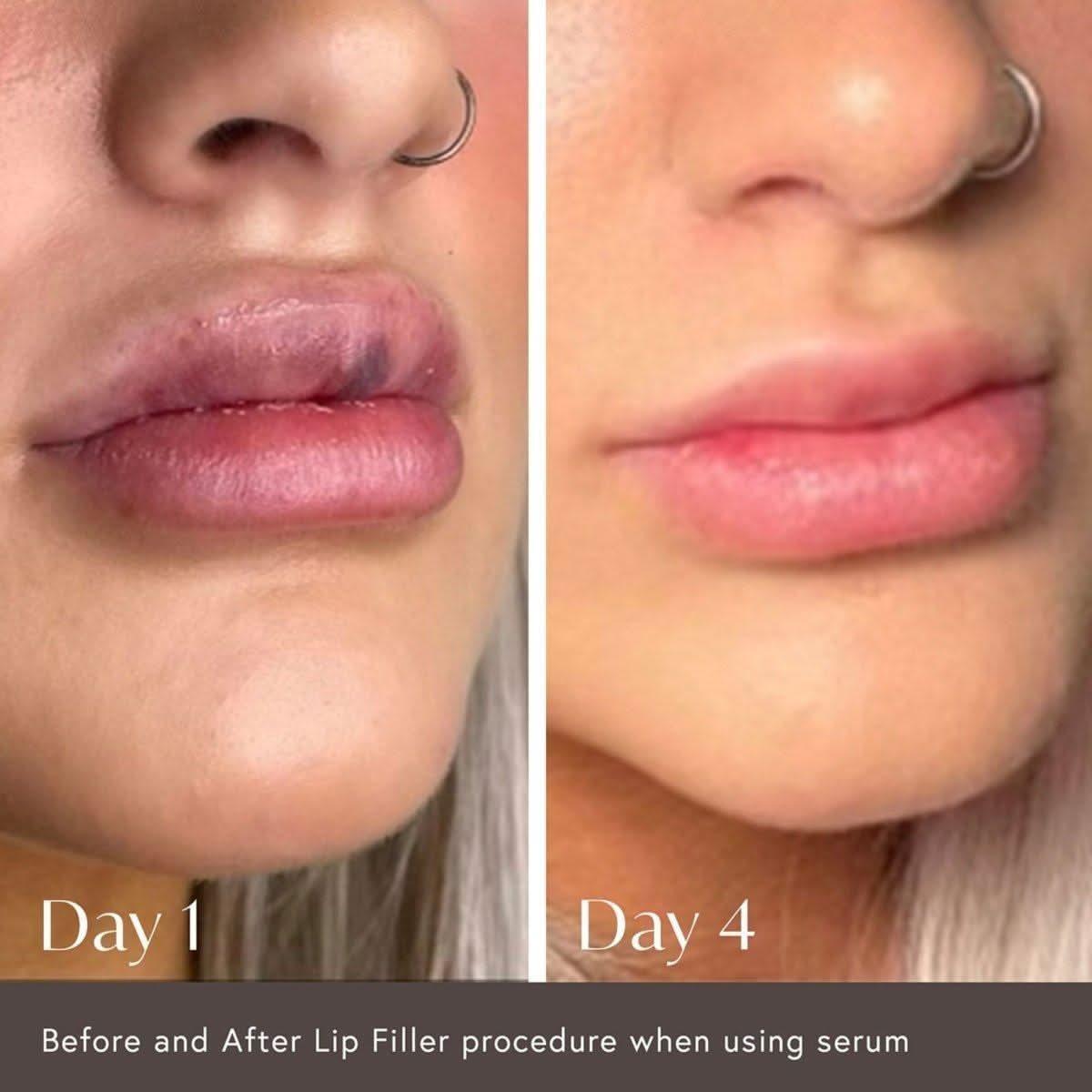 Viktor Michael Hidden Agenda Pre and Post Injection Care Serum - 30ml - Glam Global UKViktor Michael