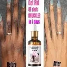 Intense Knuckle Whitening Serum: Unveil Radiant, Rejuvenated Hands - Glam Global UKGlam Global UK