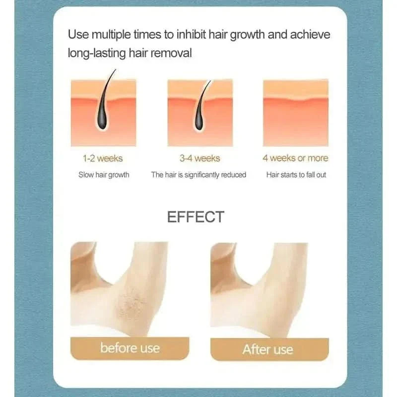 Laser Hair Removal System - Glam Global UKGlam Global UK